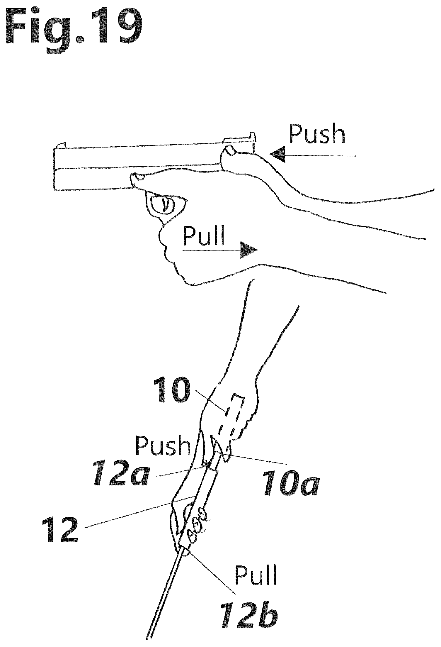 Patent US12377328 Figure 5 – Golf putter