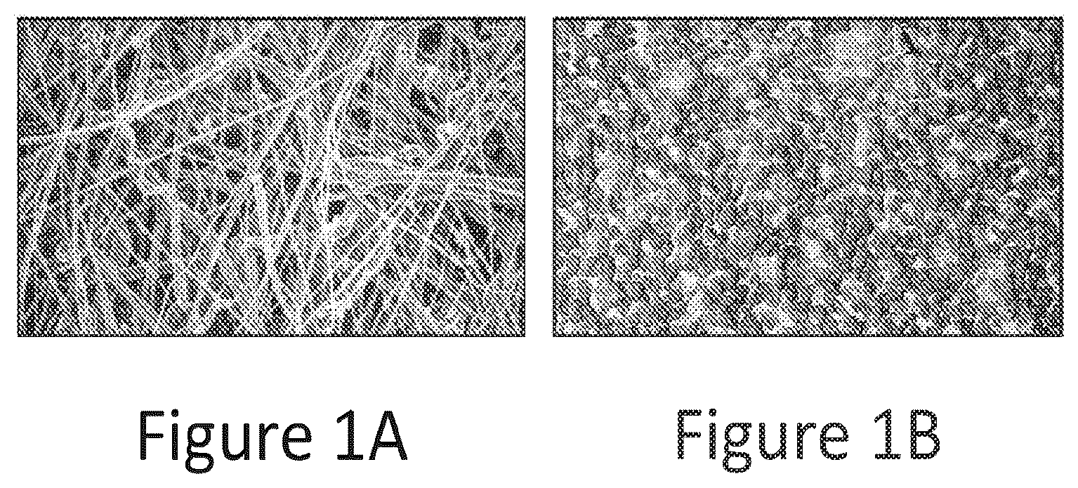 Patent US12377376 Figure 1 – Method and apparatus for enhanced separation and removal of contaminants and irradiated particulates from fluids