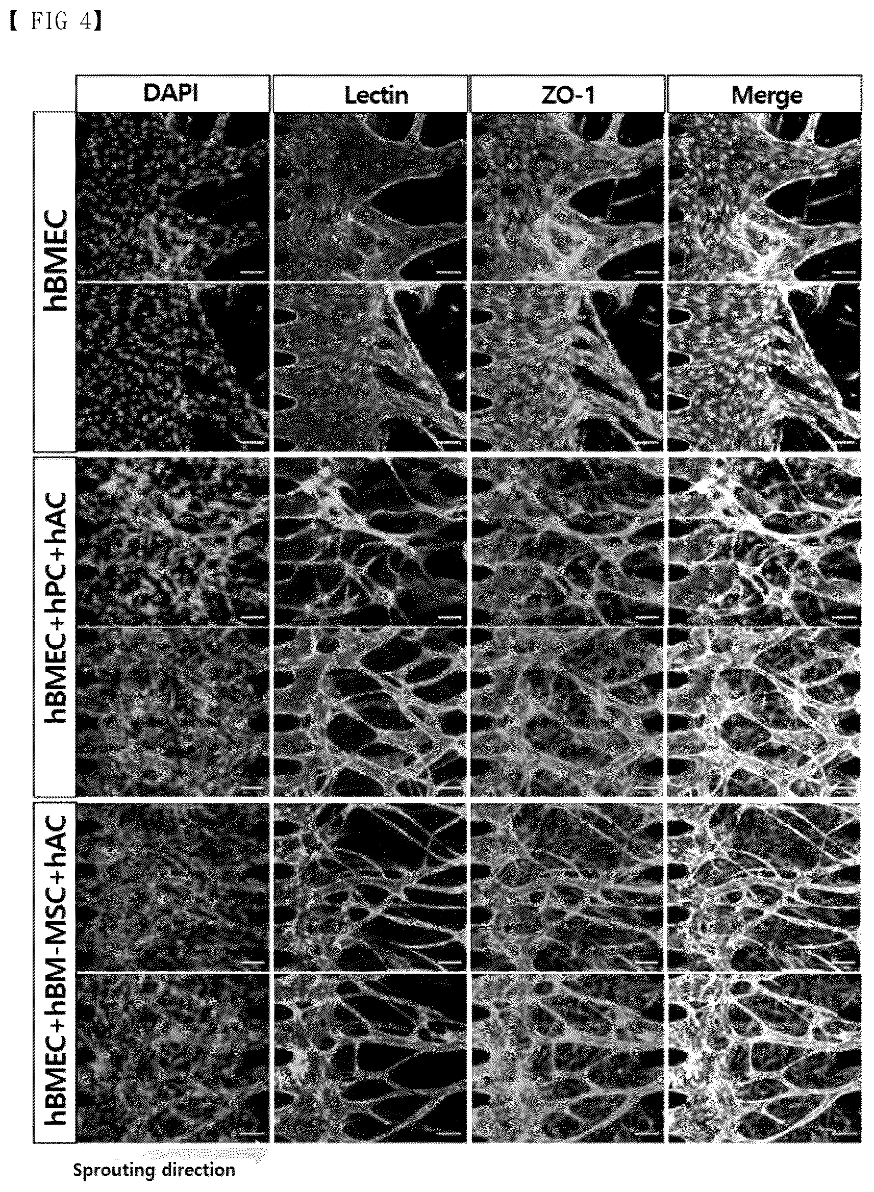 Patent US12377413 Figure 4 – Blood brain barrier-on-a-chip