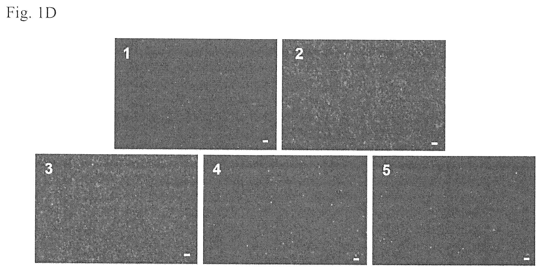 Patent US12377414 Figure 2 – Microfluidic device and method for detecting an infected cell in a fluid sample