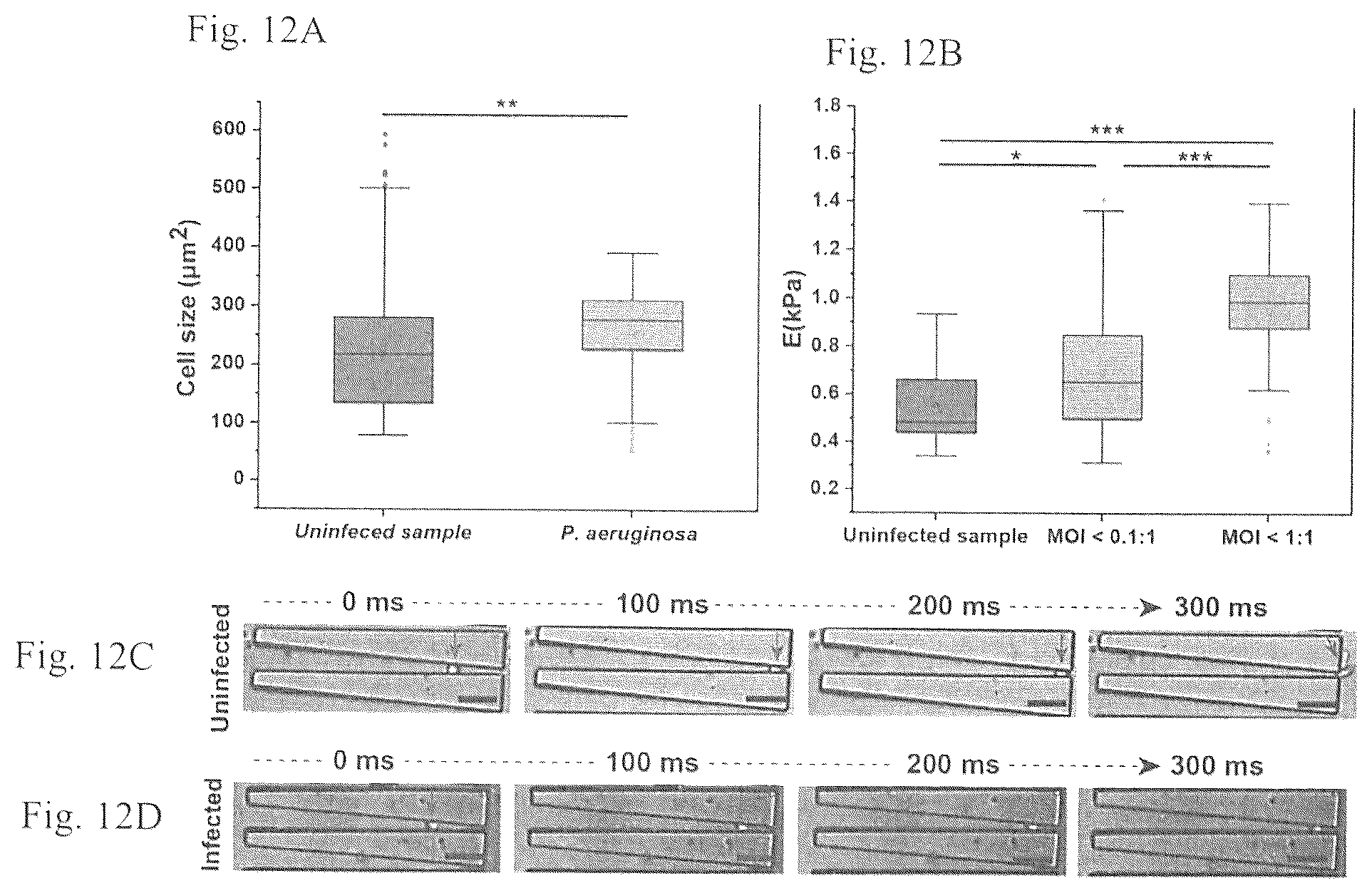 Patent US12377414 Figure 13 – Microfluidic device and method for detecting an infected cell in a fluid sample