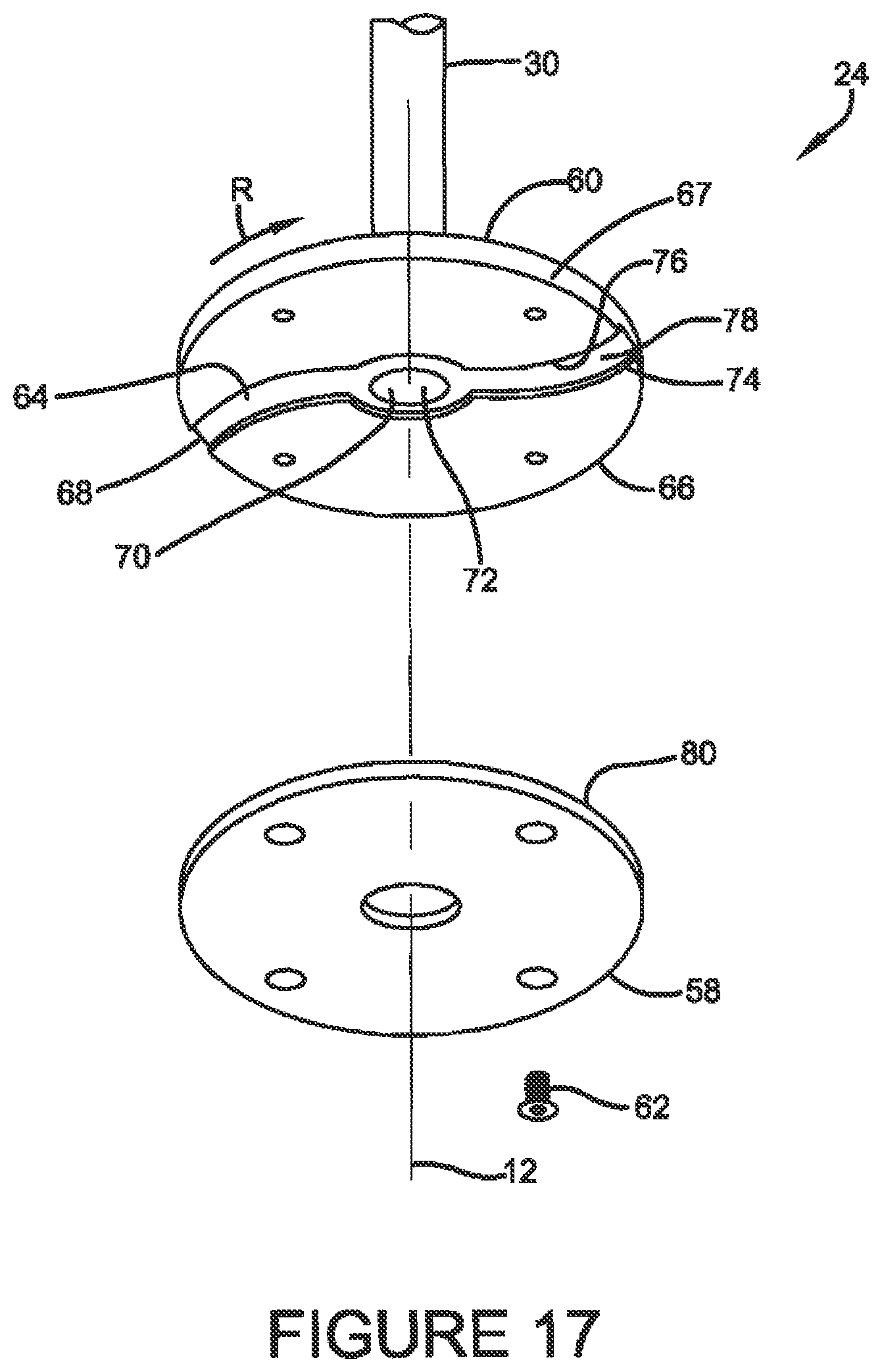 Patent US12377423 Figure 17 – Centrifuge system for separating cells in suspension
