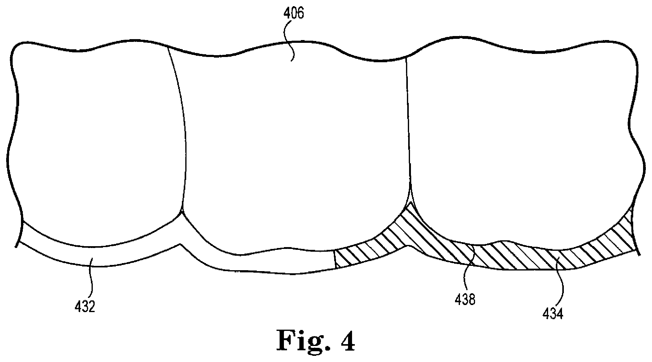 Patent US12377493 Figure 4 – Laser cutting