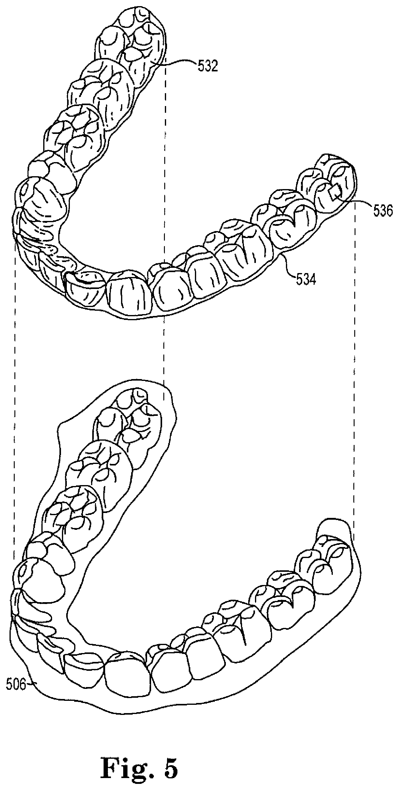Patent US12377493 Figure 5 – Laser cutting