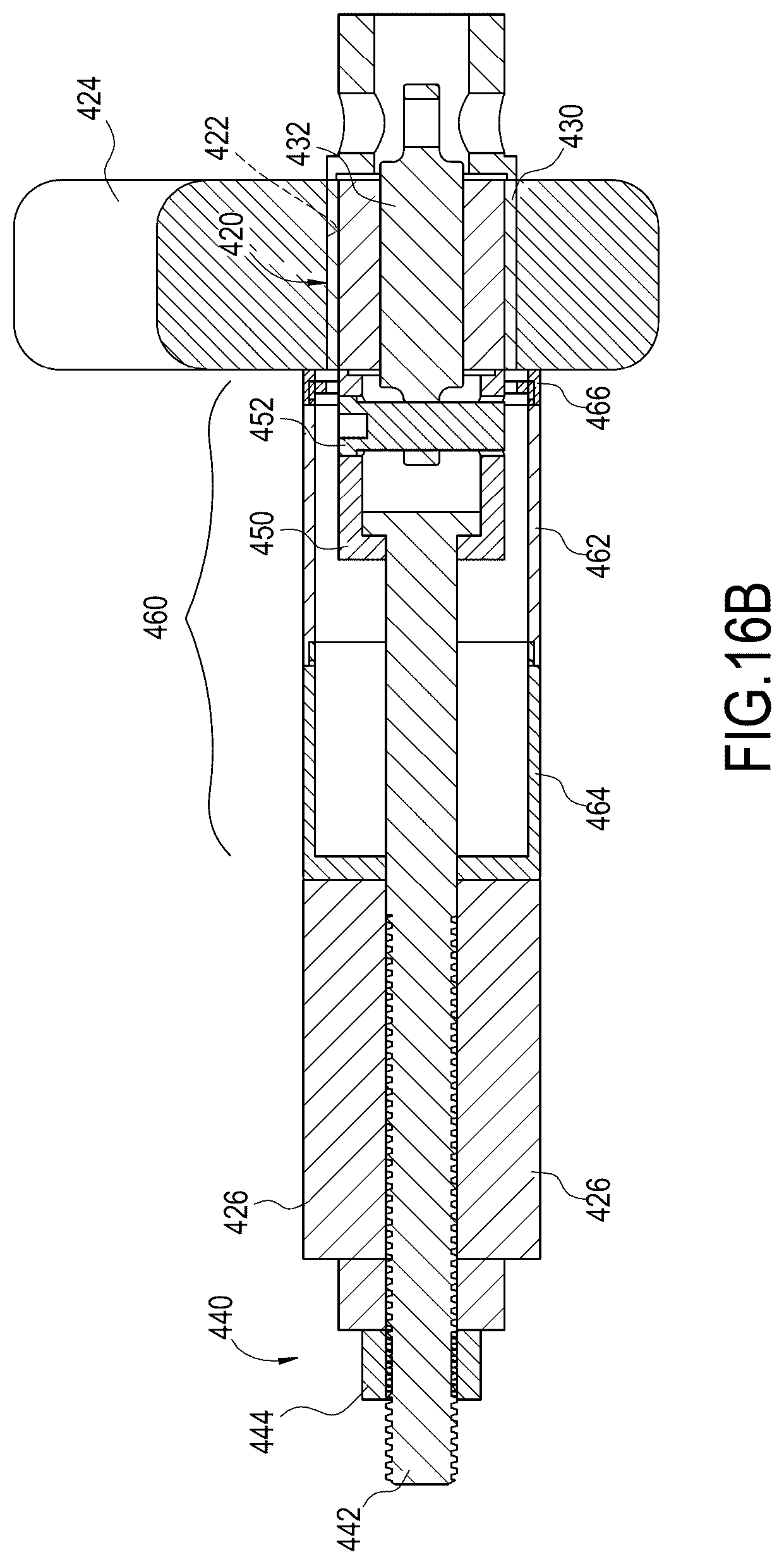 Patent US12377527 Figure 11 – Systems and methods for inserting and removing bushing assemblies