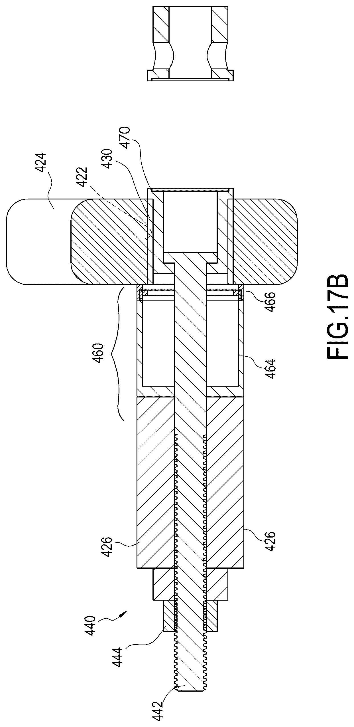 Patent US12377527 Figure 13 – Systems and methods for inserting and removing bushing assemblies