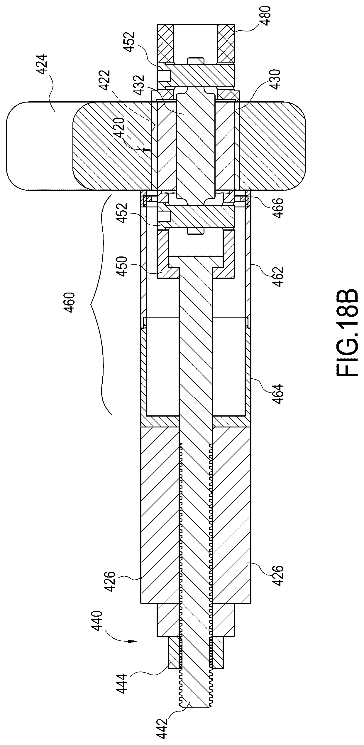 Patent US12377527 Figure 15 – Systems and methods for inserting and removing bushing assemblies