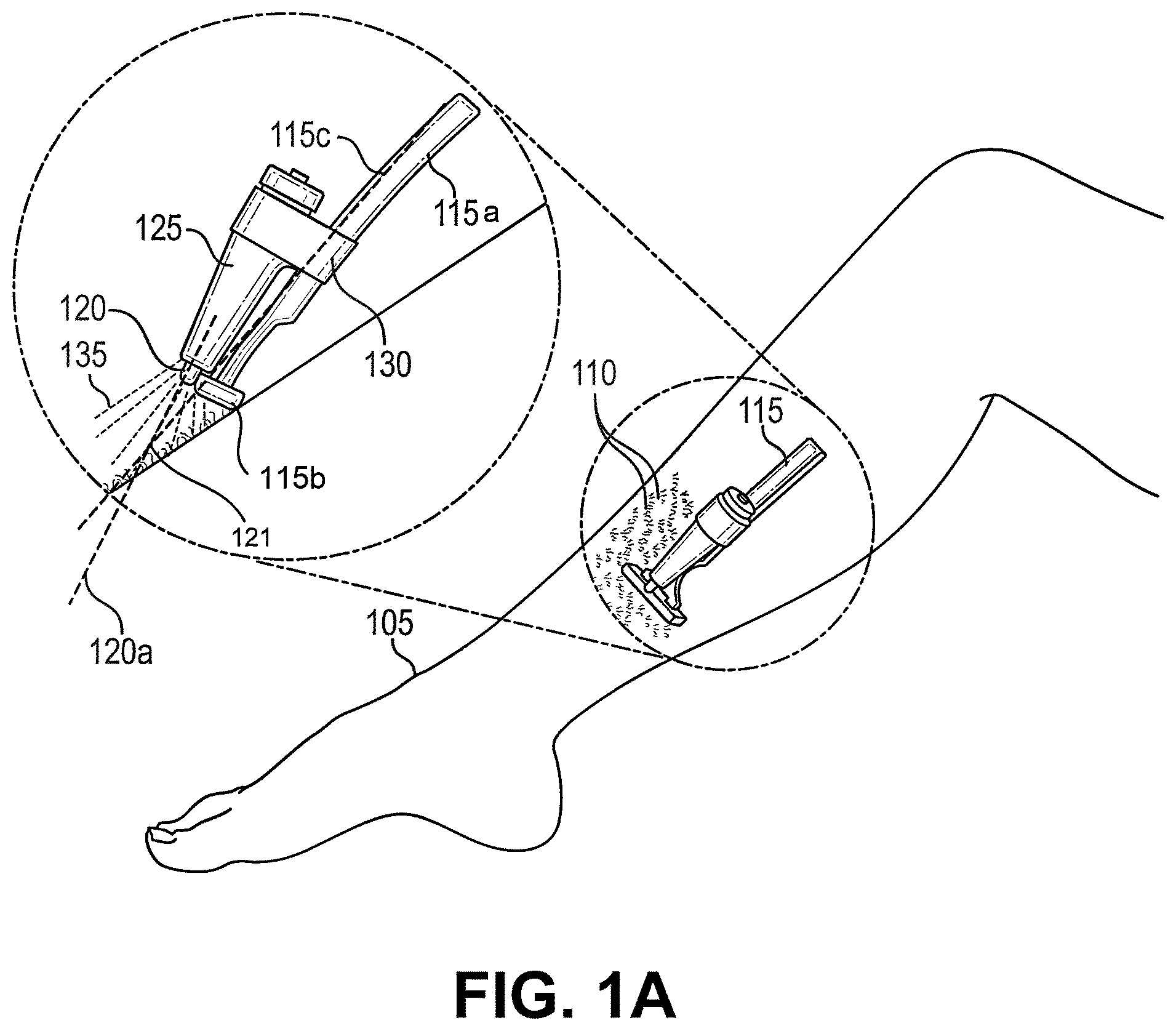 Patent US12377562 Figure 1 – Lamp module for detachable attachment to shaving razor