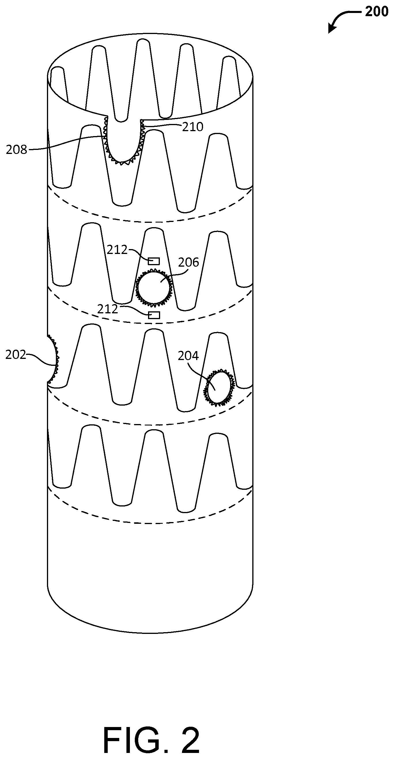 Patent US12377609 Figure 2 – Fenestration template for endovascular repair of aortic aneurysms