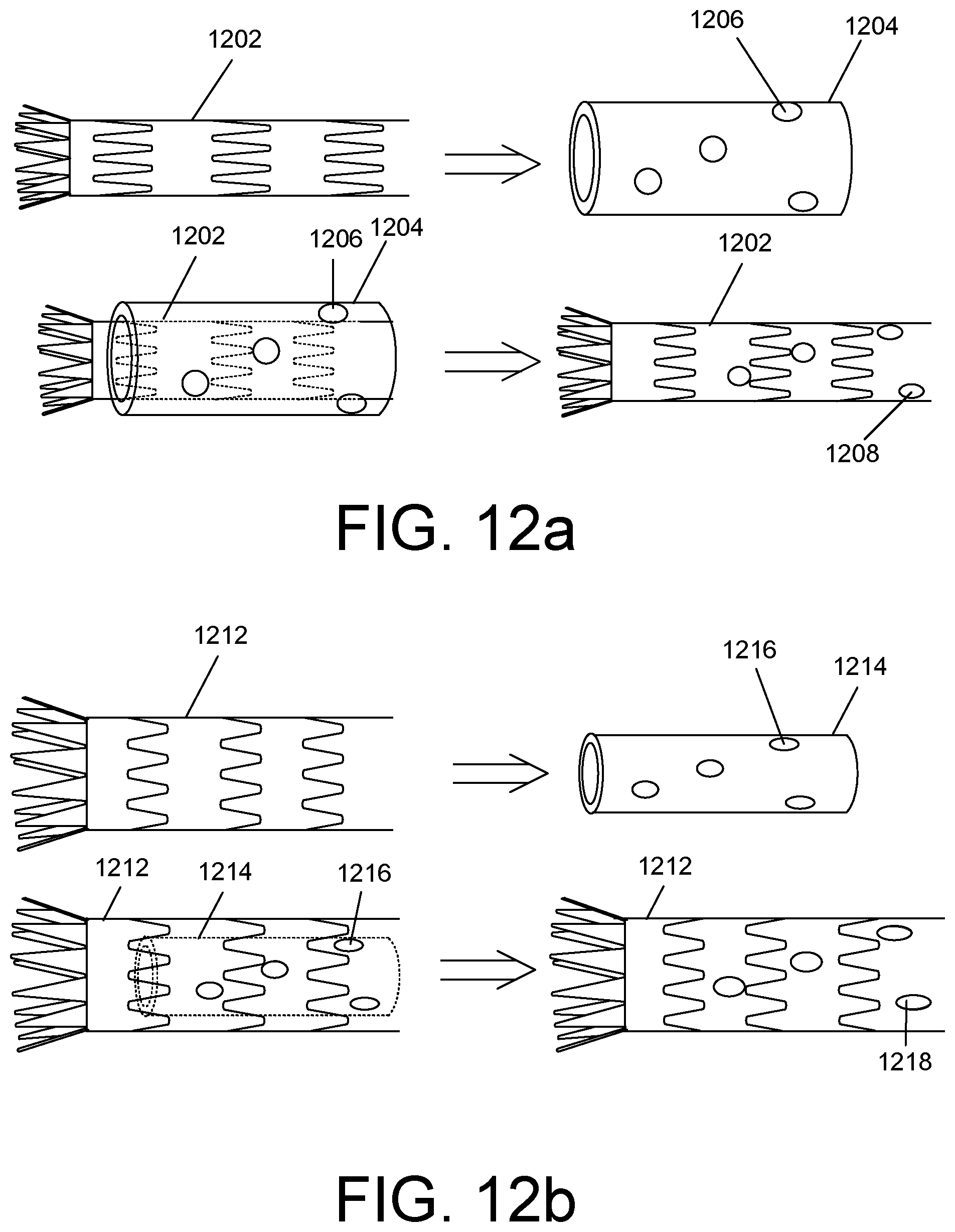 Patent US12377609 Figure 13 – Fenestration template for endovascular repair of aortic aneurysms