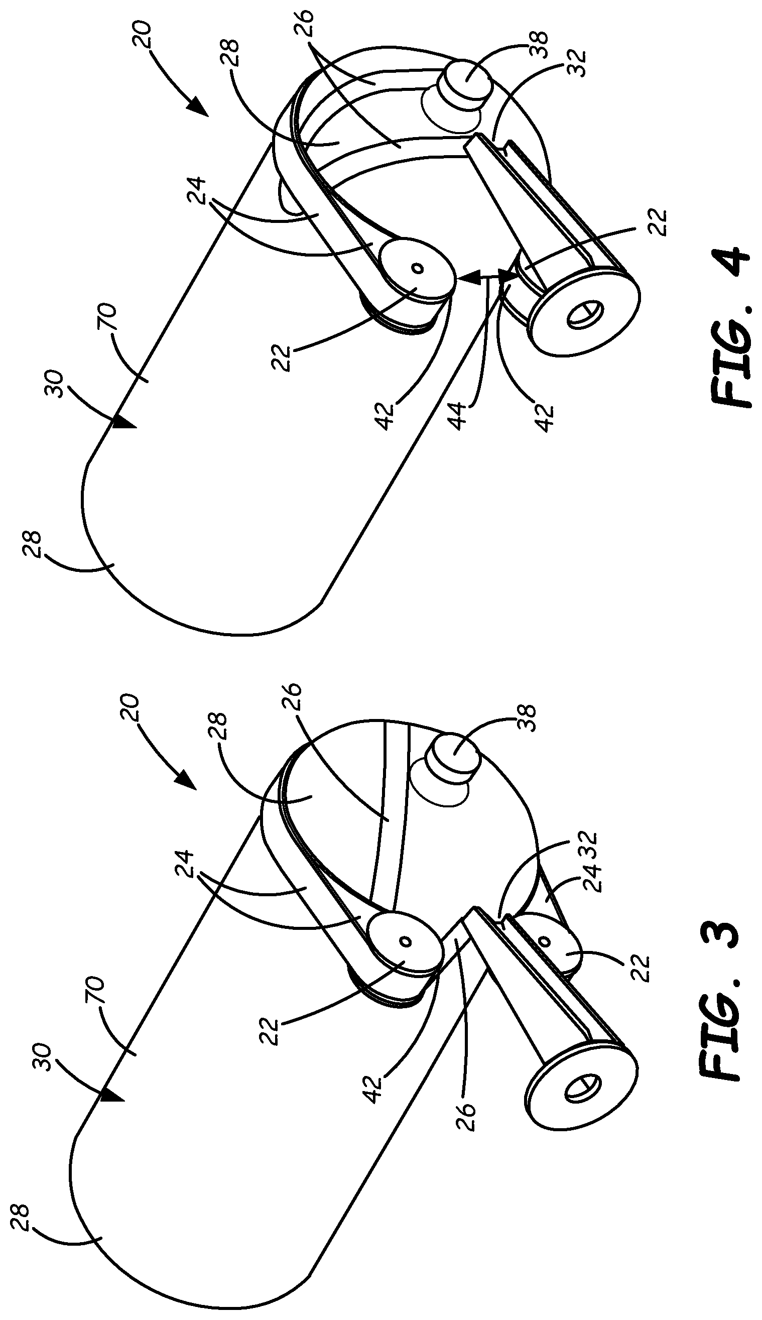 Patent US12377616 Figure 2 – Device for stabilizing localized dome reinforcement