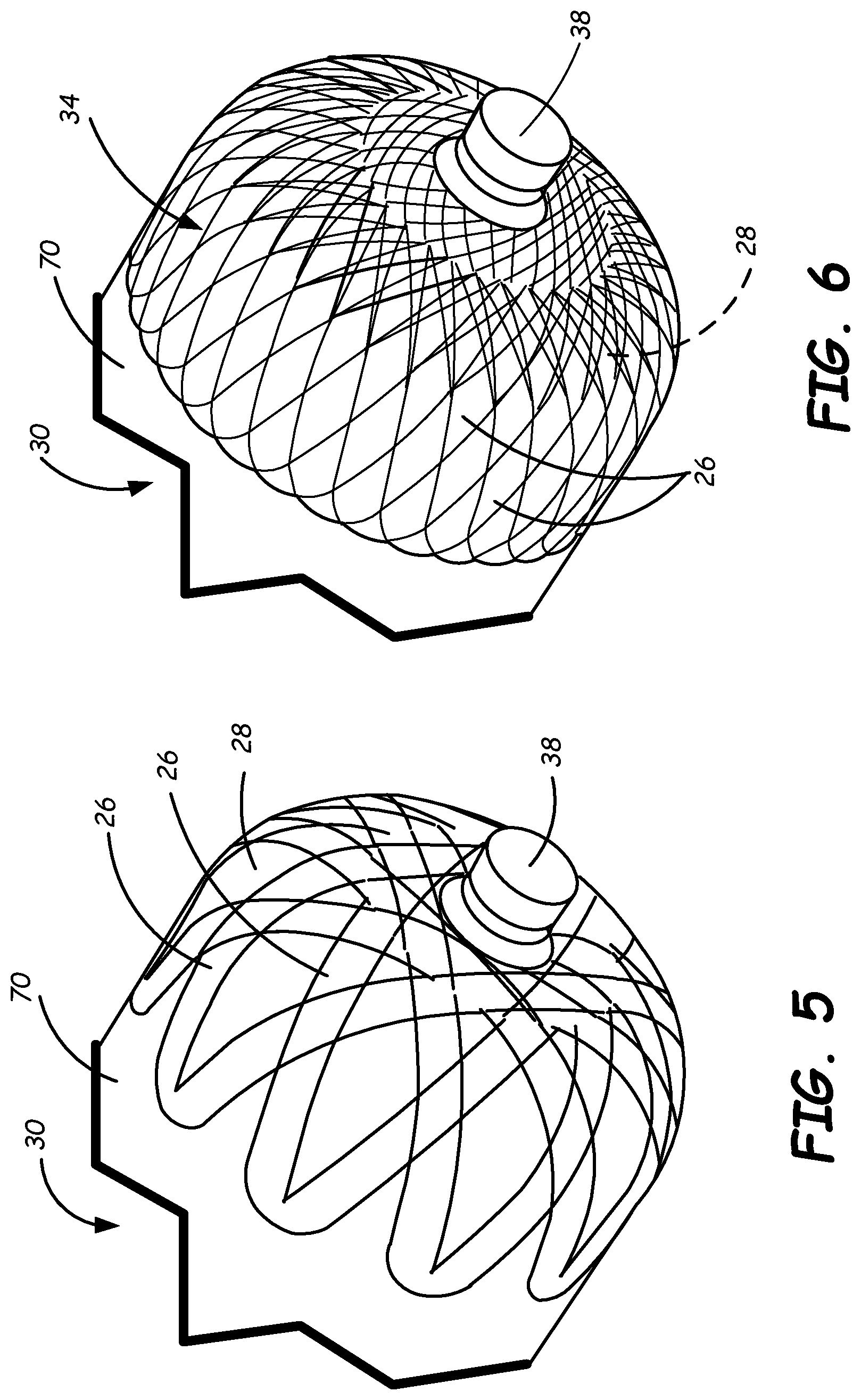 Patent US12377616 Figure 3 – Device for stabilizing localized dome reinforcement