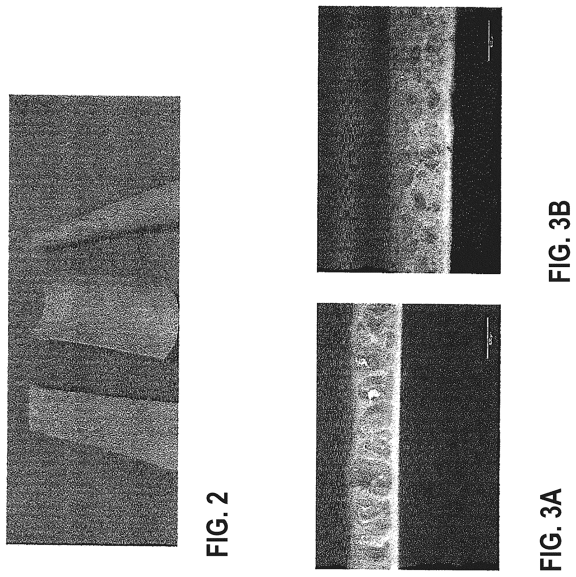 Patent US12377634 Figure 2 – Composite sheet and manufacturing method for a foamed decorative sheet free of PVC and plasticizers