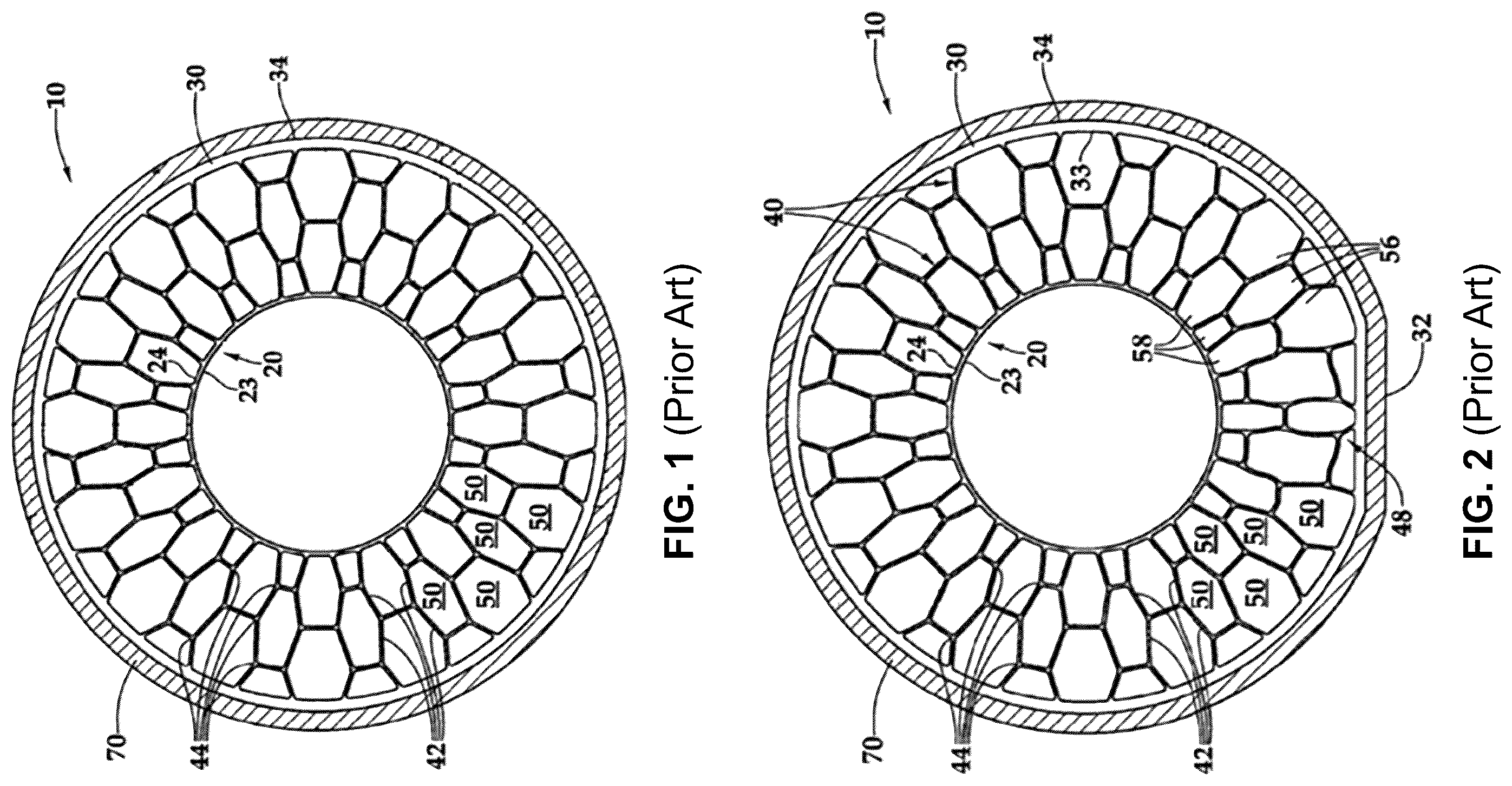 Patent US12377684 Figure 1 – Non-pneumatic tire having multilayer spokes