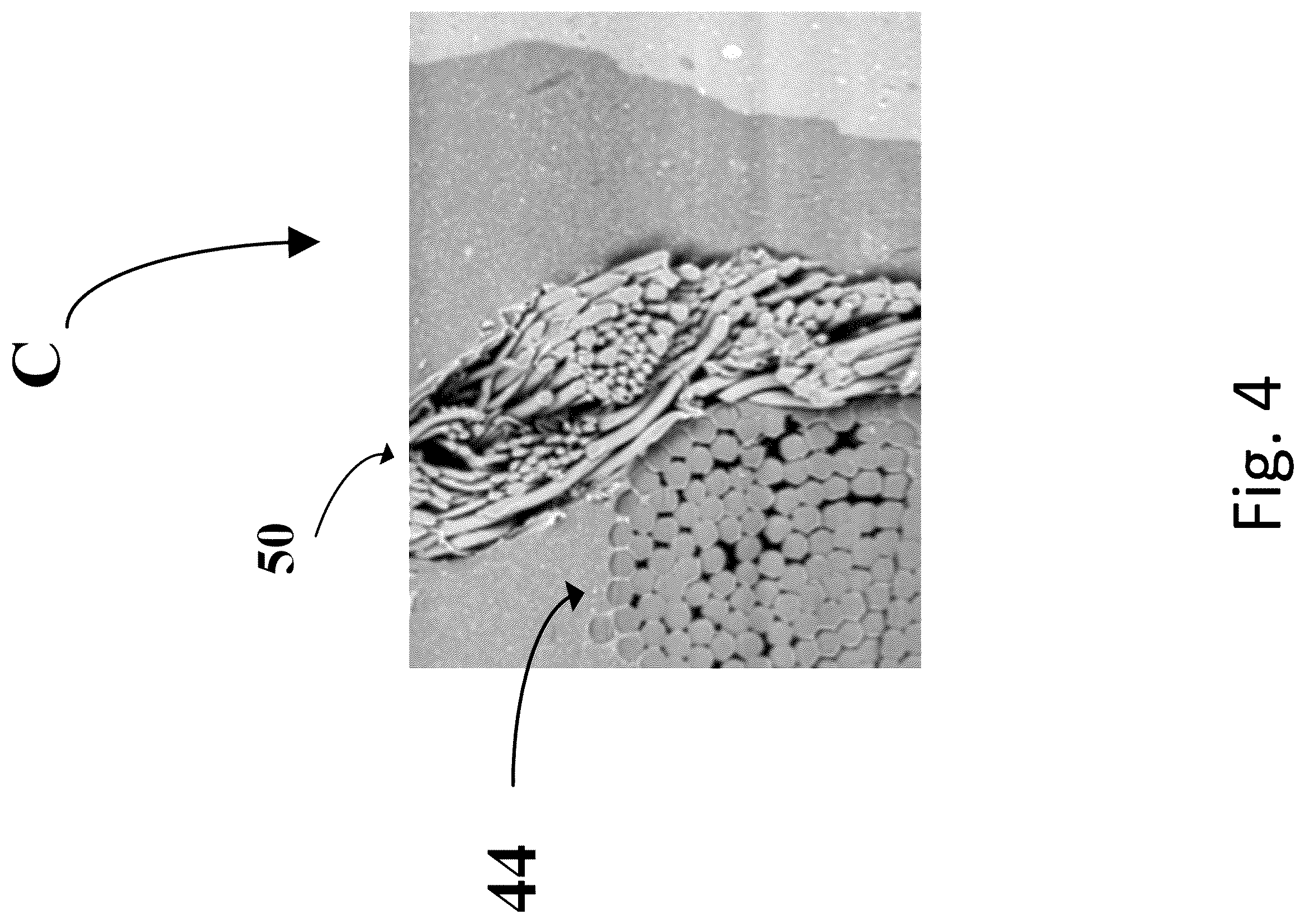 Patent US12377685 Figure 3 – Tire fabric comprising tousled weft reinforcing elements with low moisture absorption content