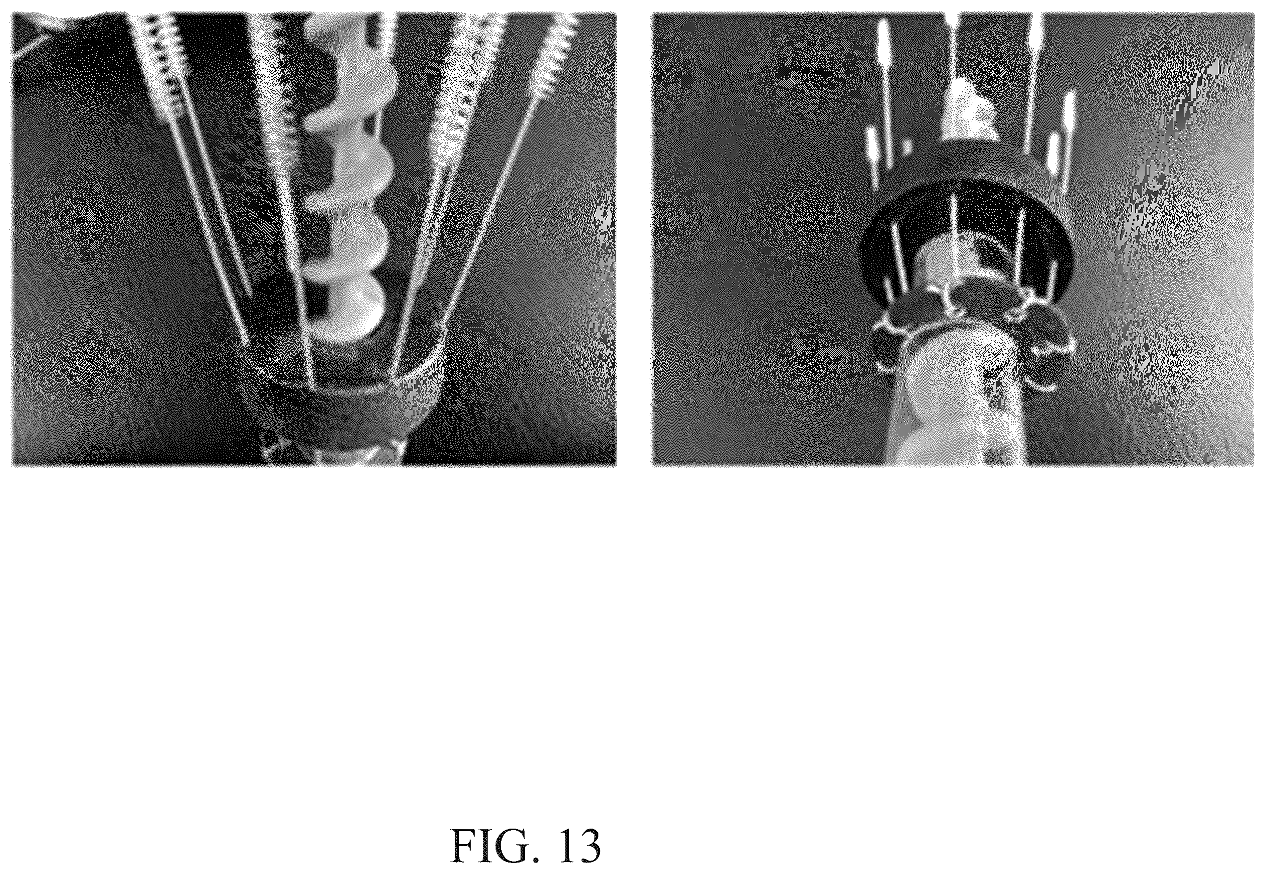 Patent US12377944 Figure 14 – Anchor system, method and mechanism for an underwater vehicle