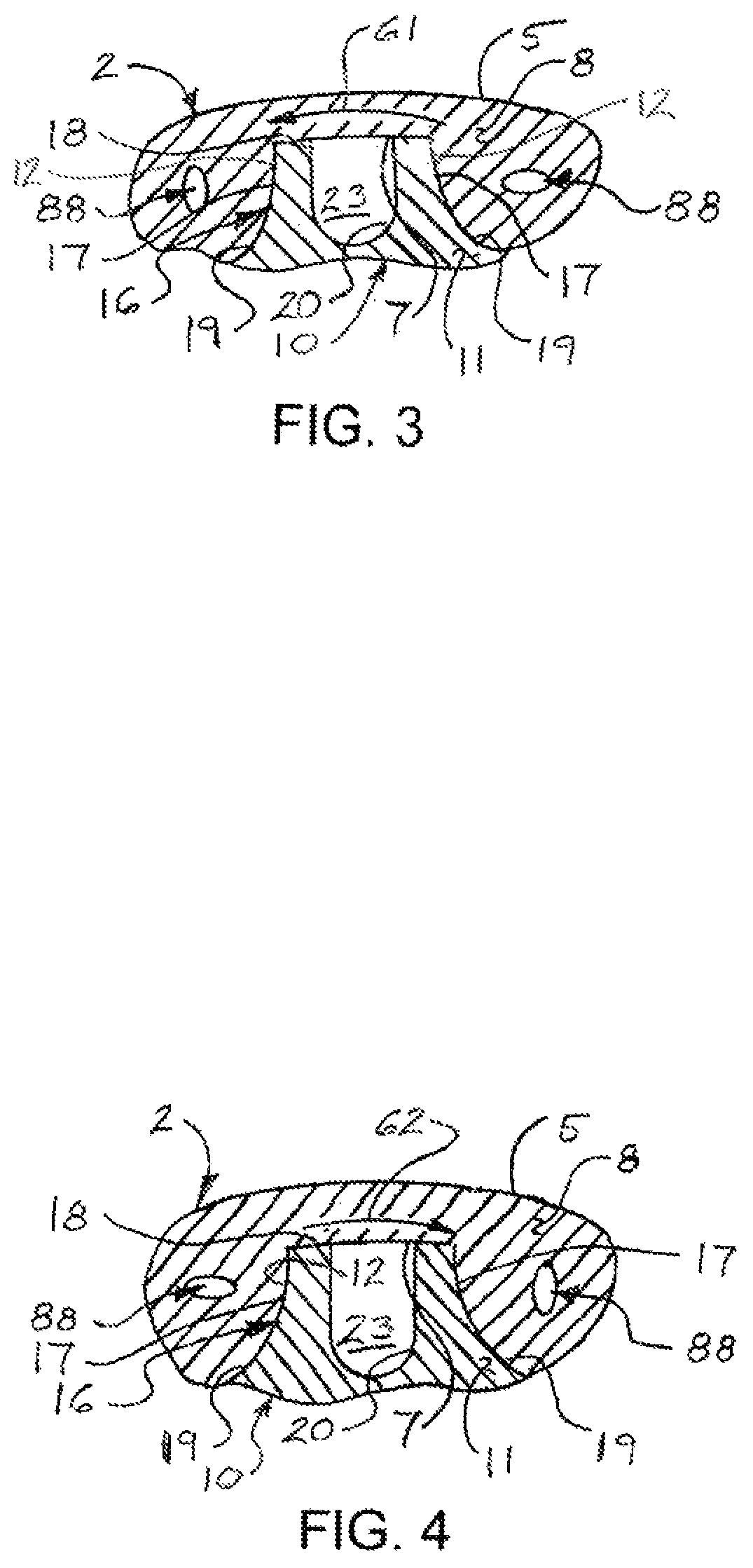 Patent US12377945 Figure 3 – Marine propellers with compression spring sleeve assemblies