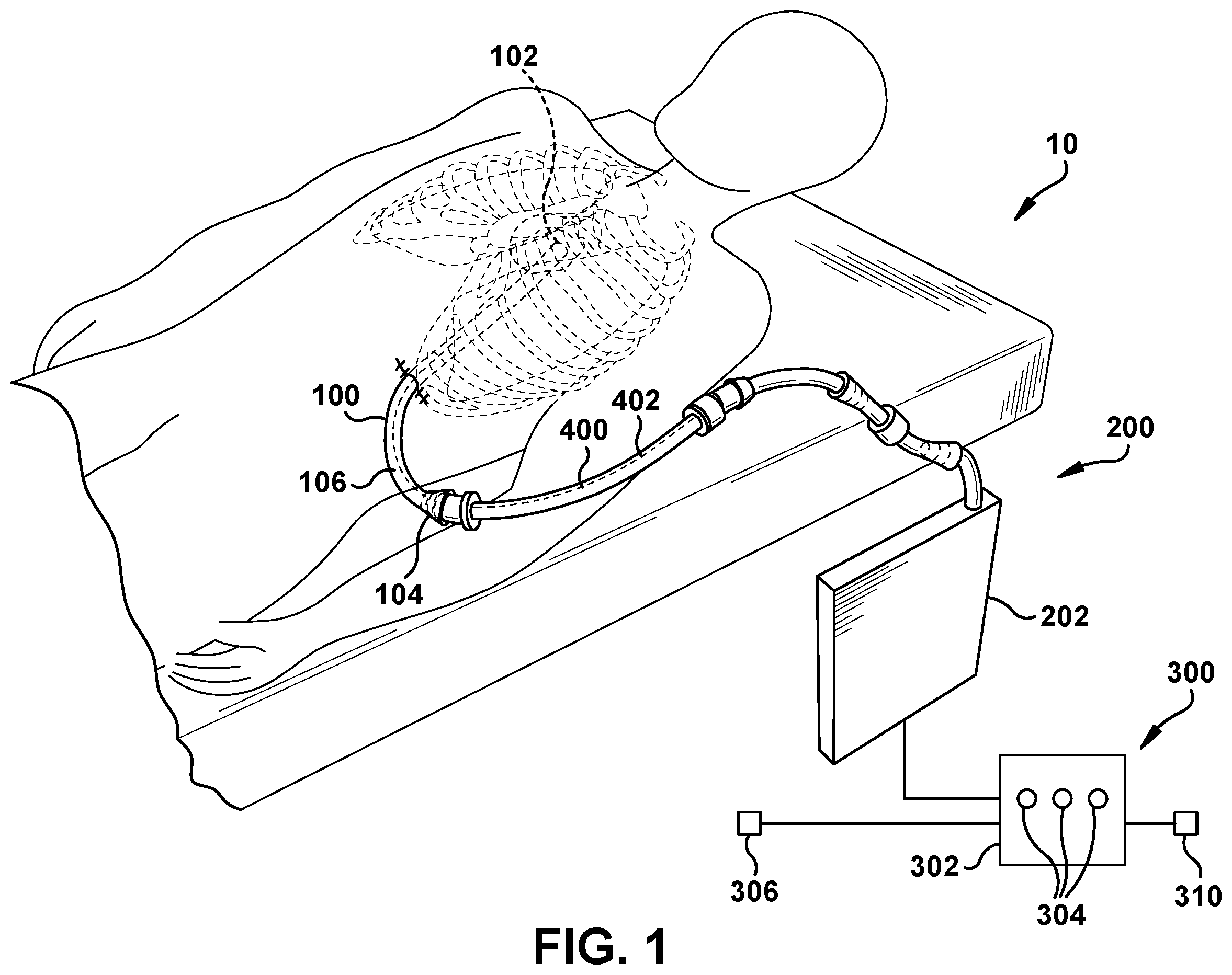 Patent US12378094 Figure 1 – Devices and methods related to medical tubes
