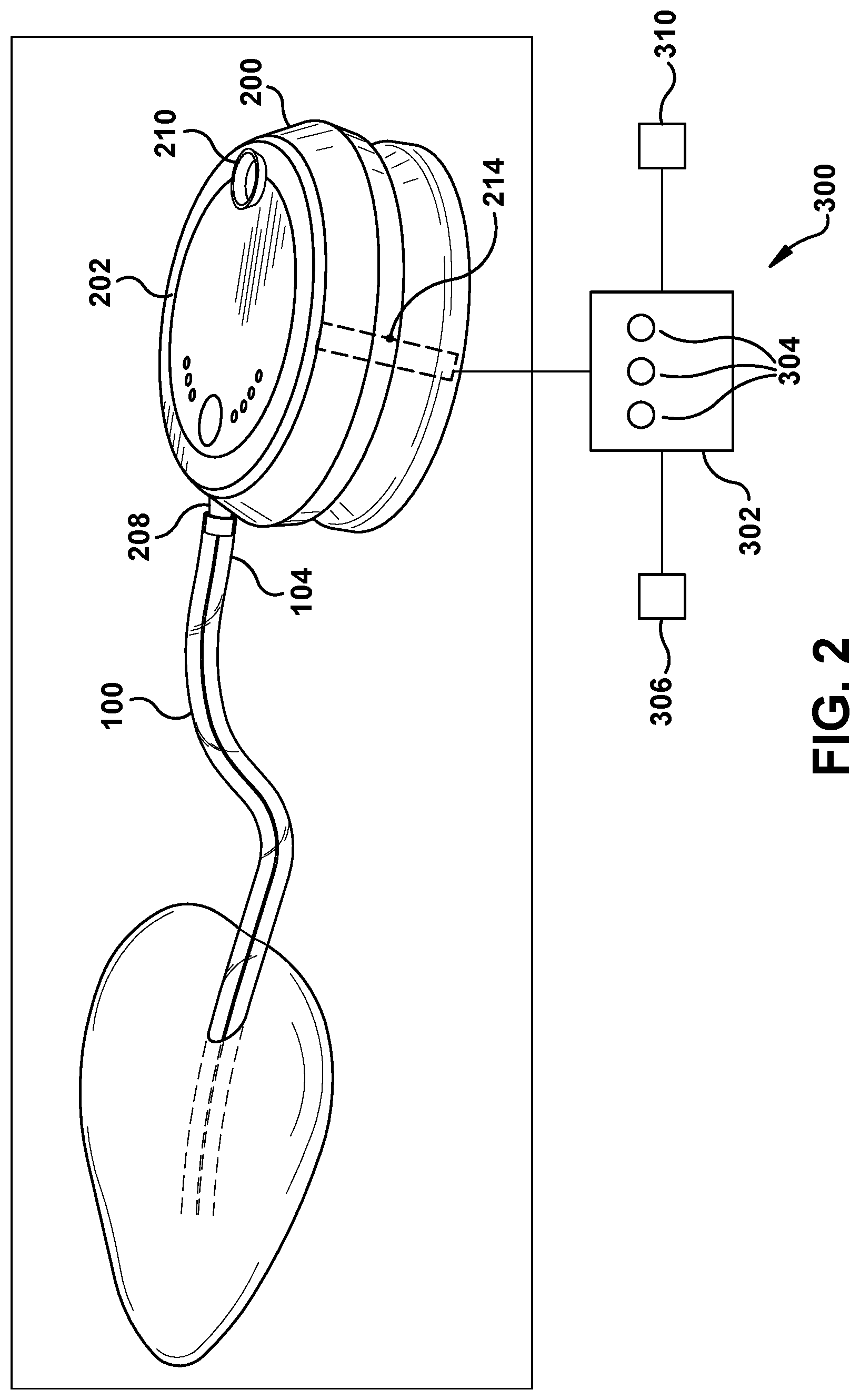 Patent US12378094 Figure 2 – Devices and methods related to medical tubes