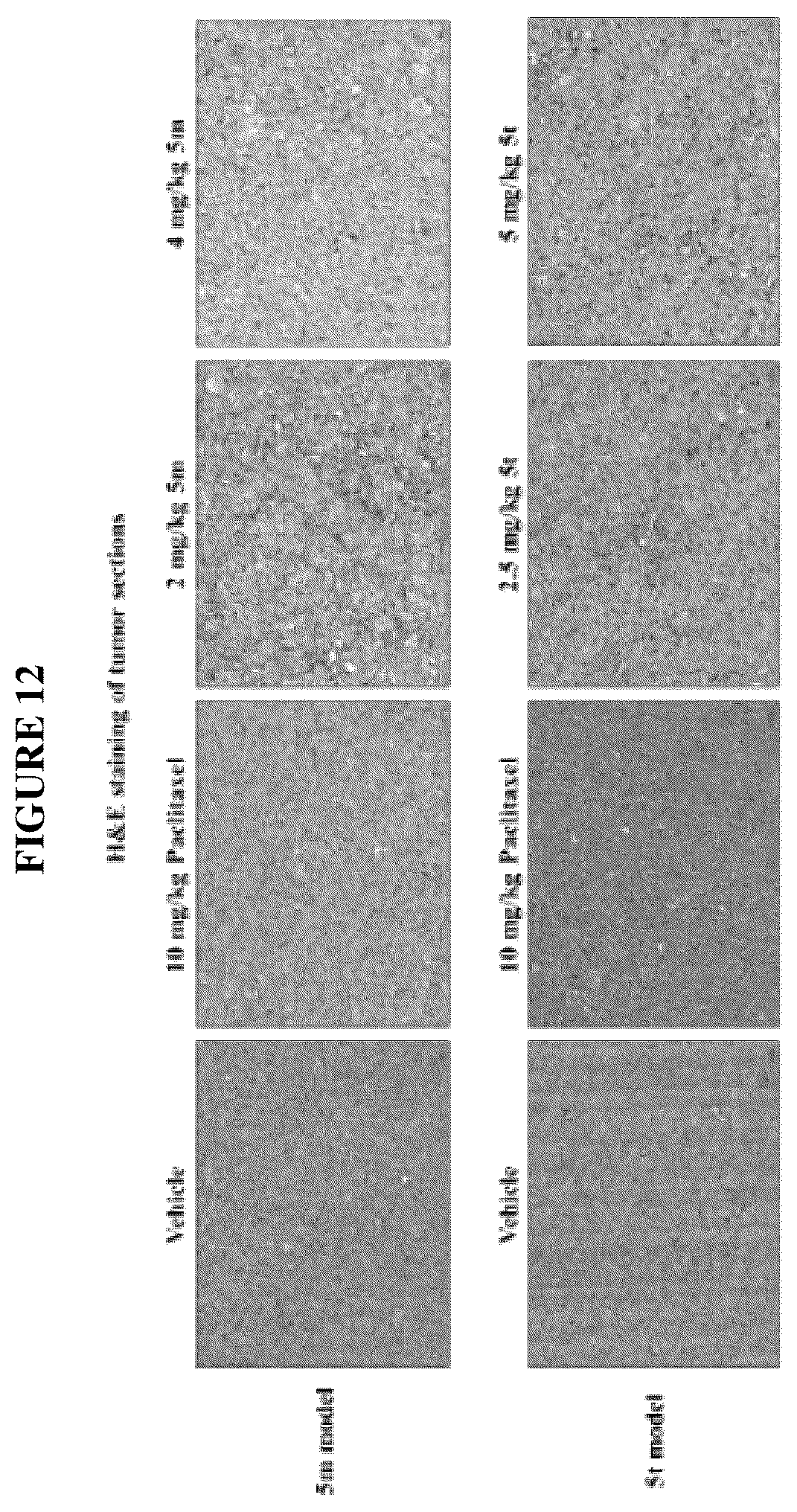 Patent US12378257 Figure 11 – Metabolically stable pyrimidinyl dihydroquinoxalinones as tubulin polymerization inhibitors