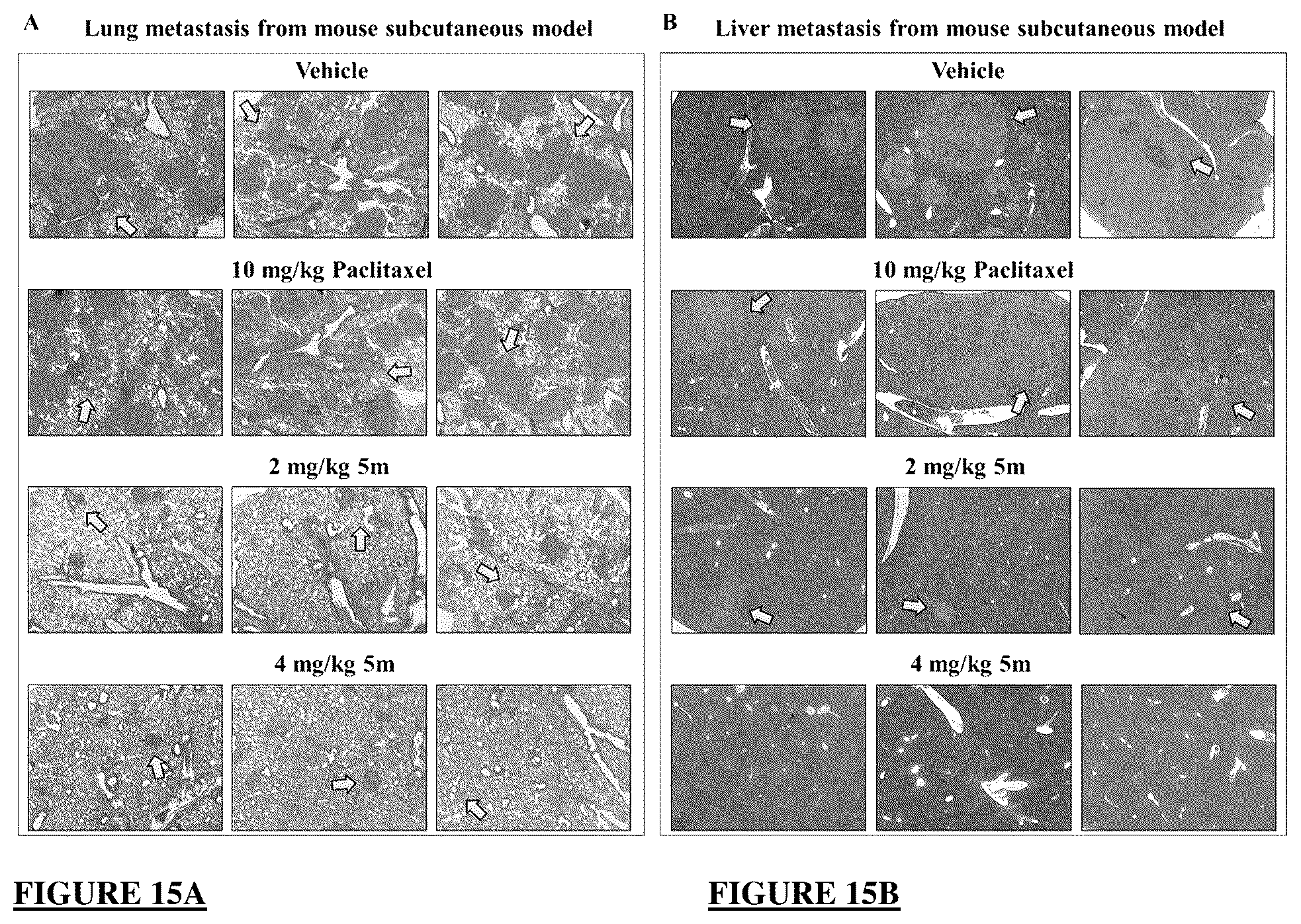 Patent US12378257 Figure 14 – Metabolically stable pyrimidinyl dihydroquinoxalinones as tubulin polymerization inhibitors
