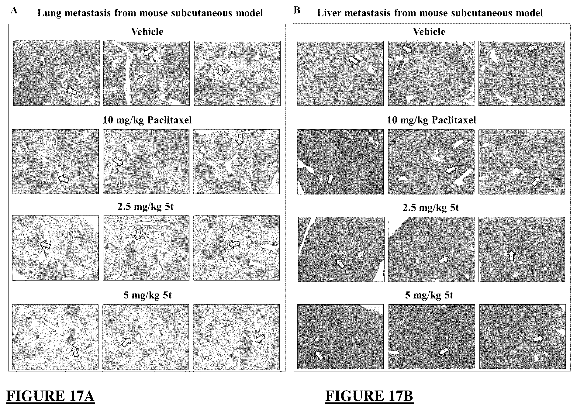 Patent US12378257 Figure 16 – Metabolically stable pyrimidinyl dihydroquinoxalinones as tubulin polymerization inhibitors
