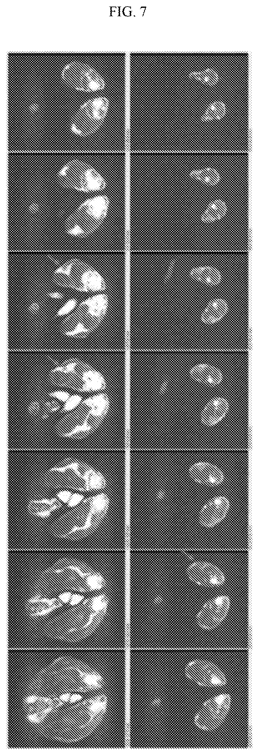 Patent US12378261 Figure 11 – One-step, fast, 18F-19F isotopic exchange radiolabeling of difluoro-dioxaborinins and use of such compounds in treatment
