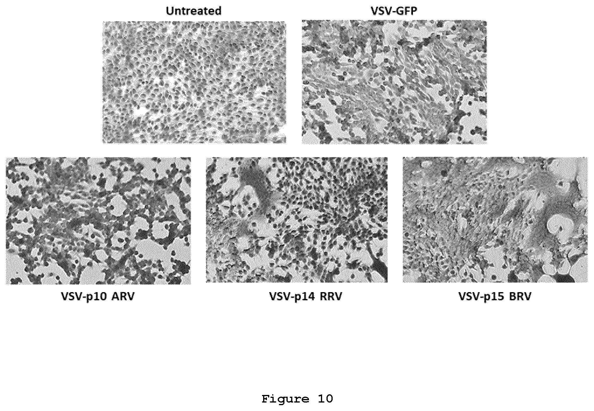 Patent US12378289 Figure 10 – Recombinant oncolytic viruses for treatment of metastatic cancers