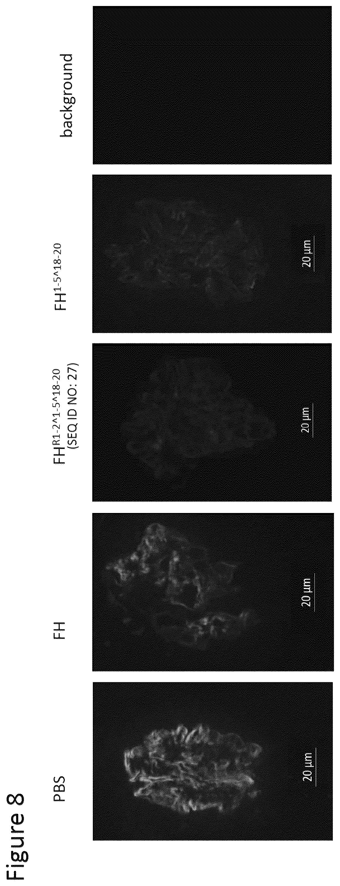 Patent US12378292 Figure 8 – Modified complement proteins and uses thereof