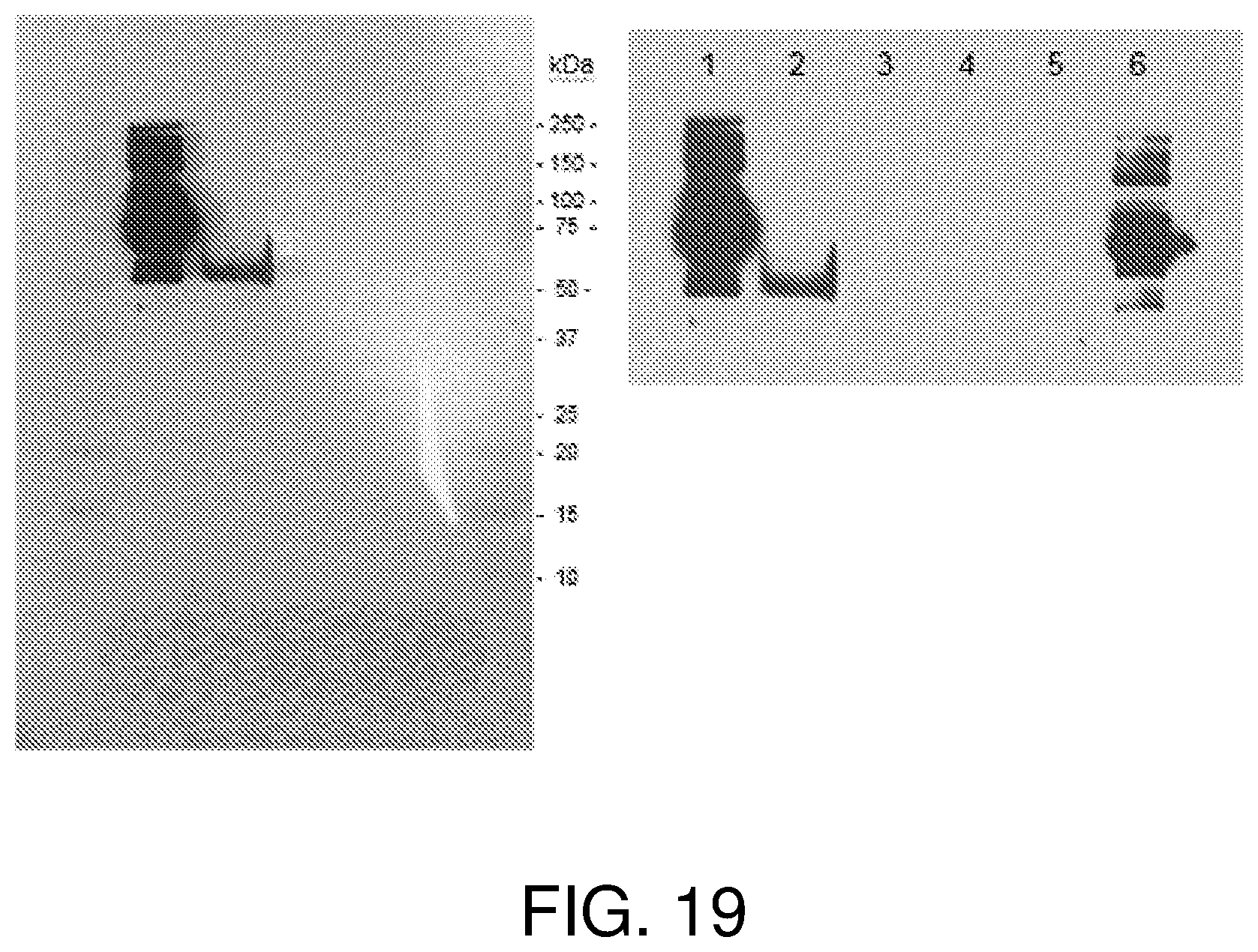 Patent US12378297 Figure 18 – Chimeric antigen receptor T cells targeting the tumor microenvironment