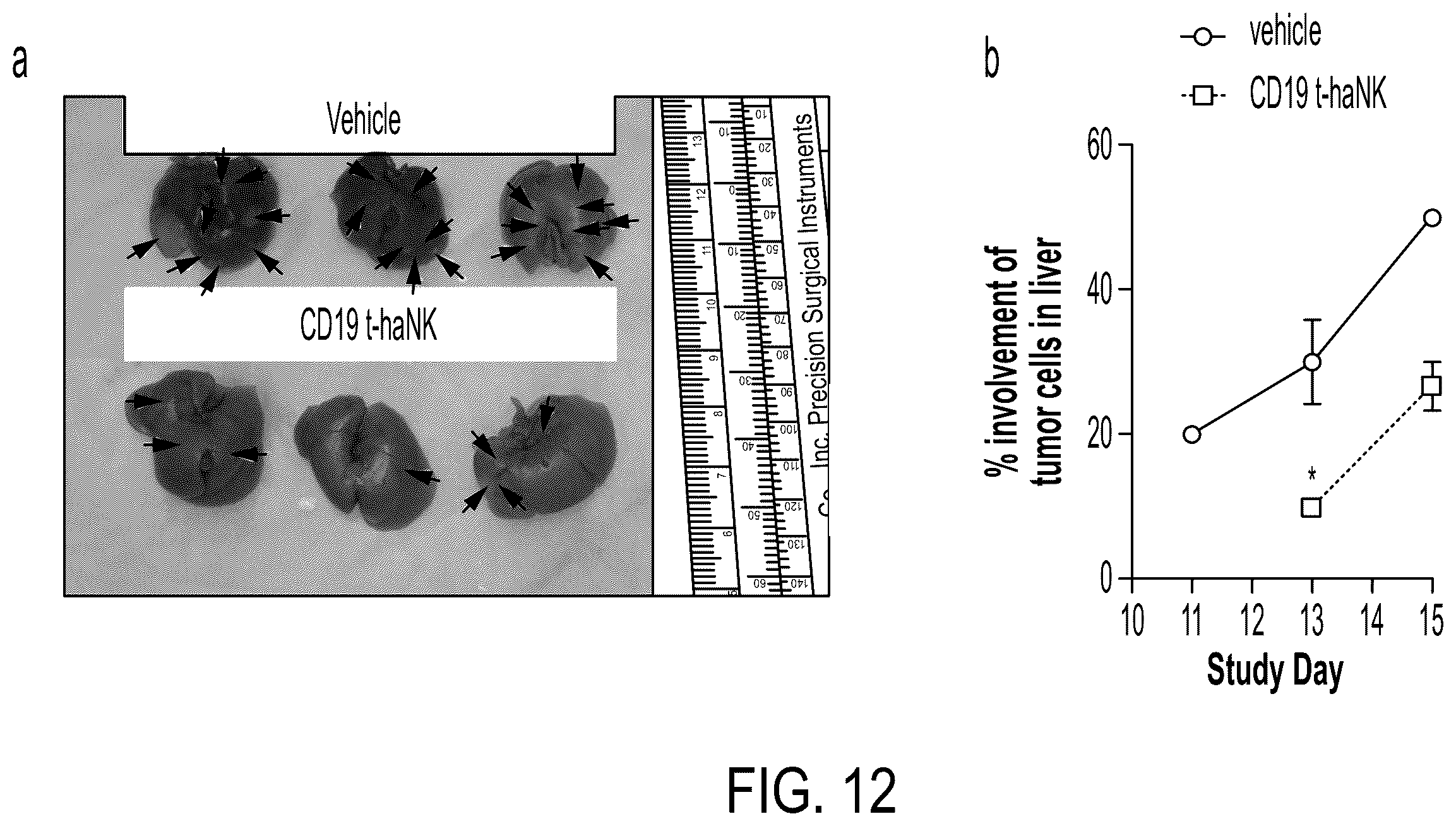 Patent US12378300 Figure 15 – Elimination of CD19-positive lymphoid malignancies by CD19-car expressing NK cells