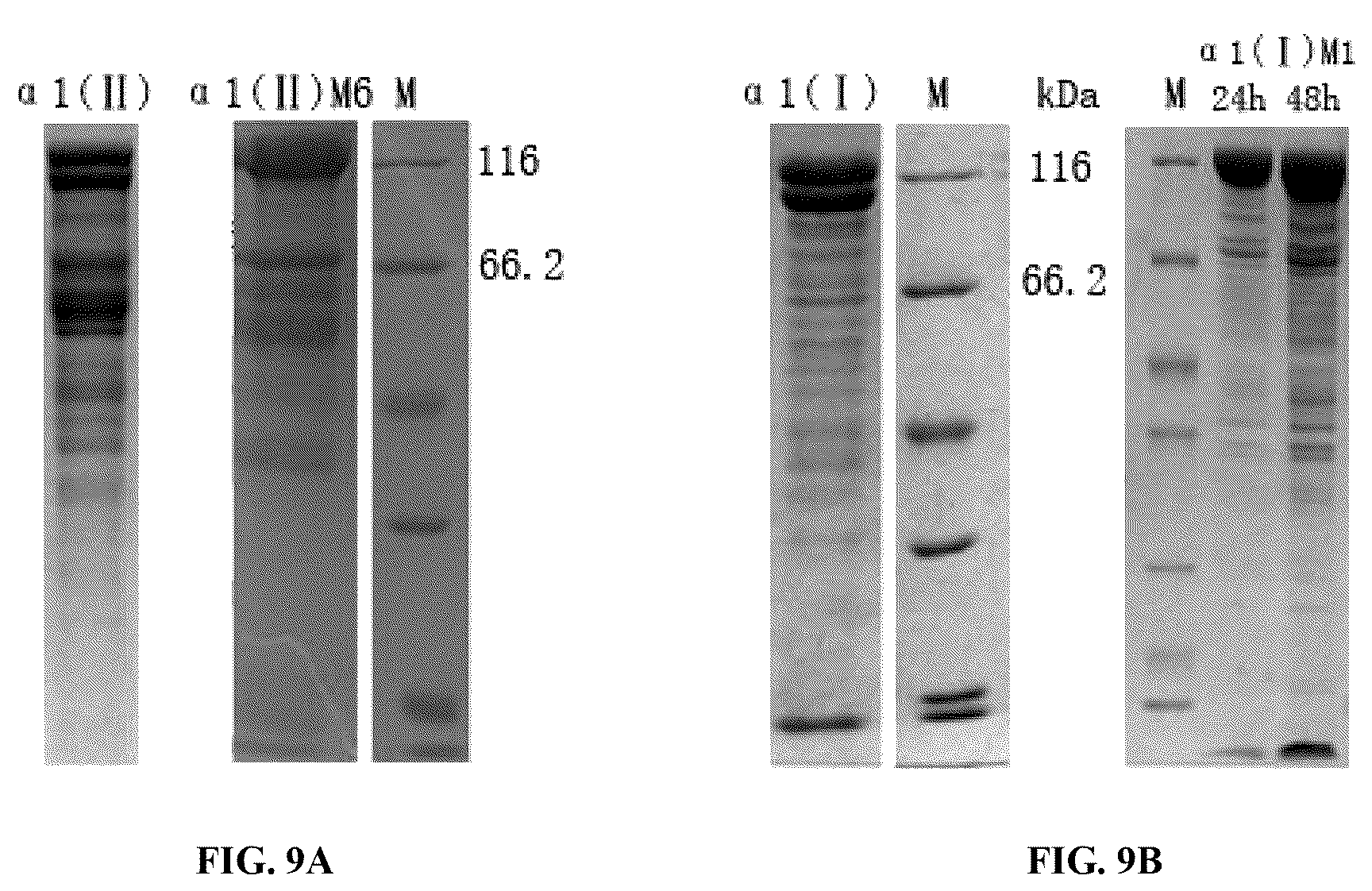 Patent US12378303 Figure 12 – Recombinant collagen and preparation method and use thereof