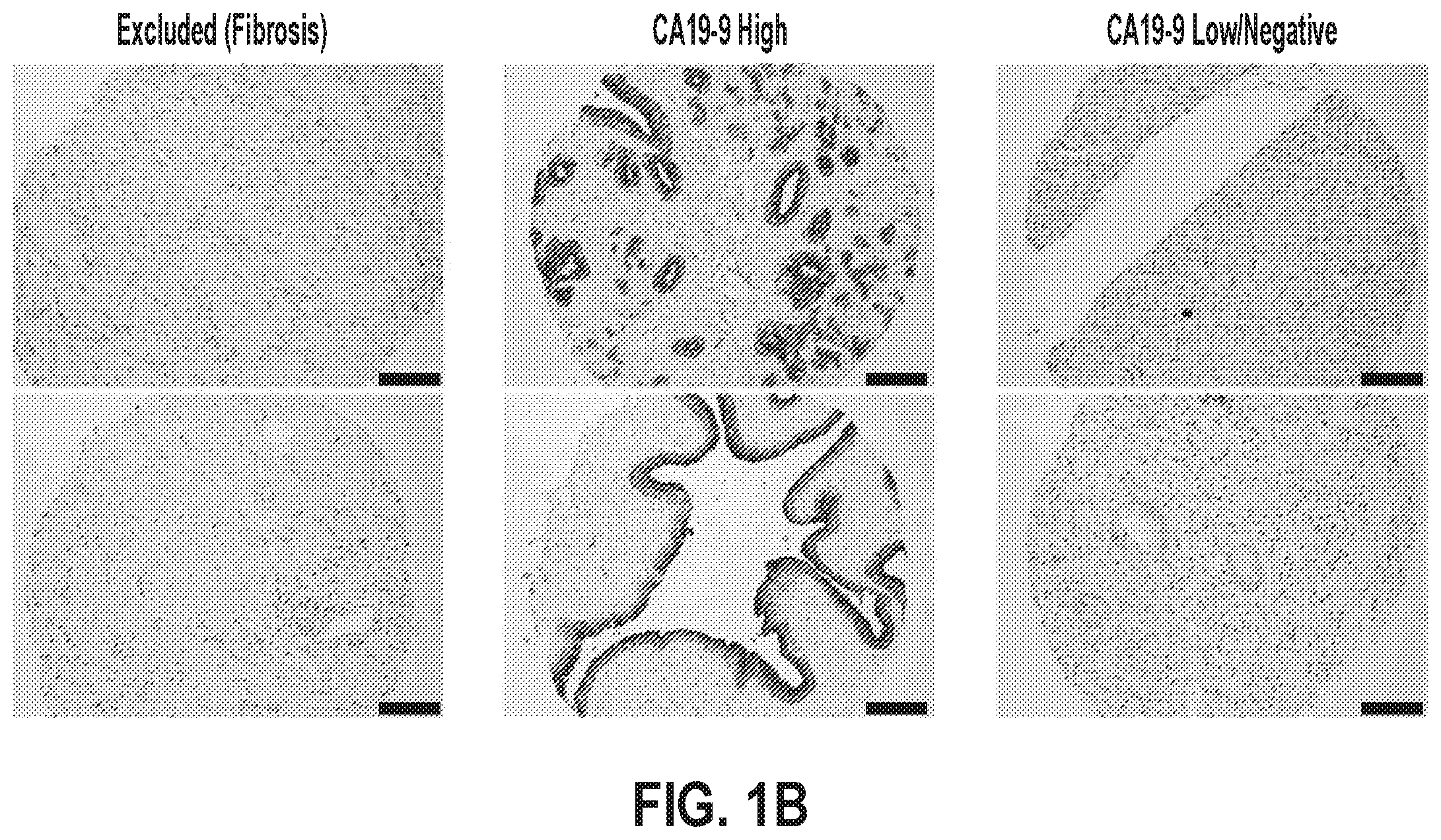 Patent US12378320 Figure 2 – Methods for treating pancreatitis