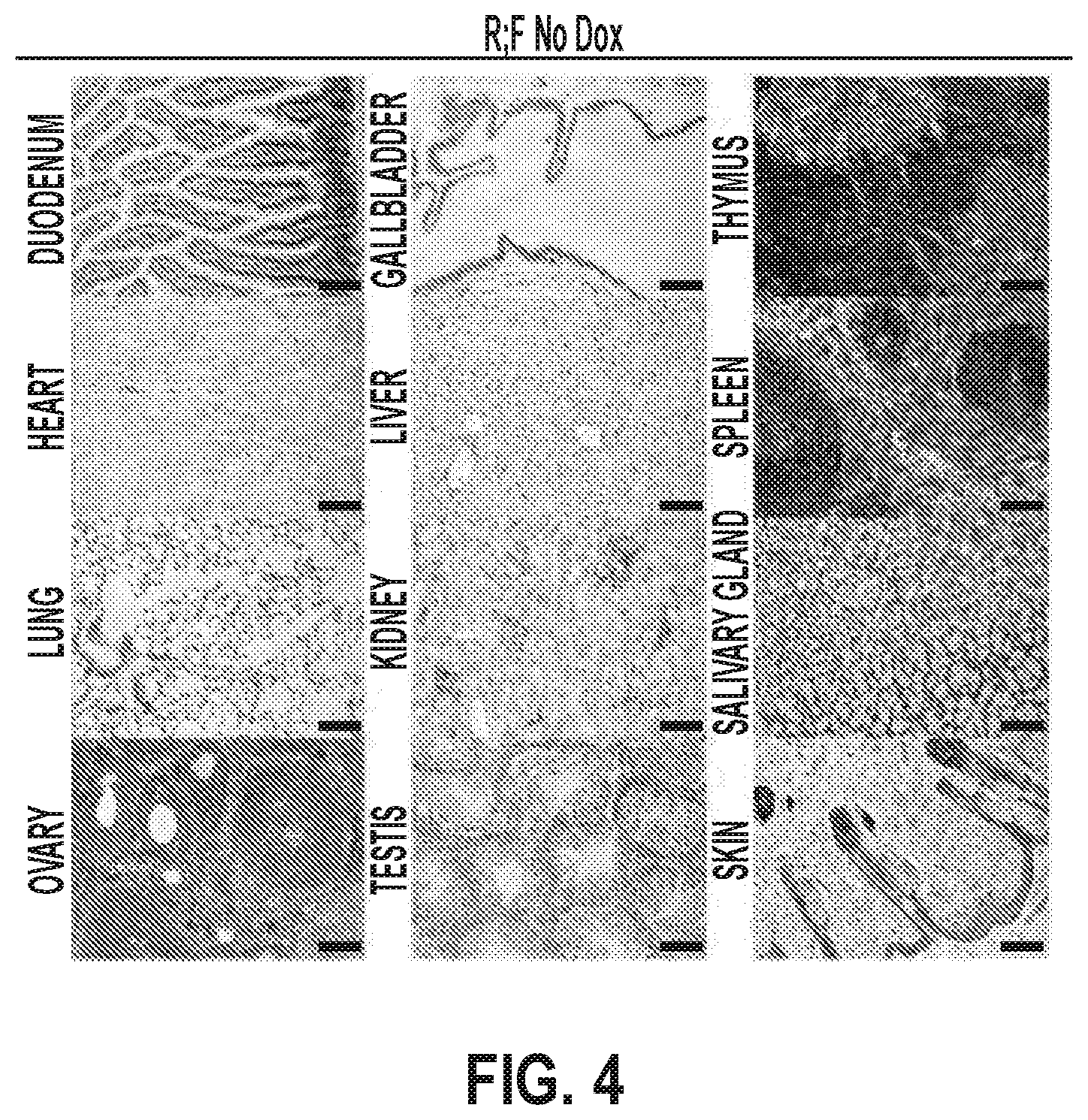 Patent US12378320 Figure 11 – Methods for treating pancreatitis