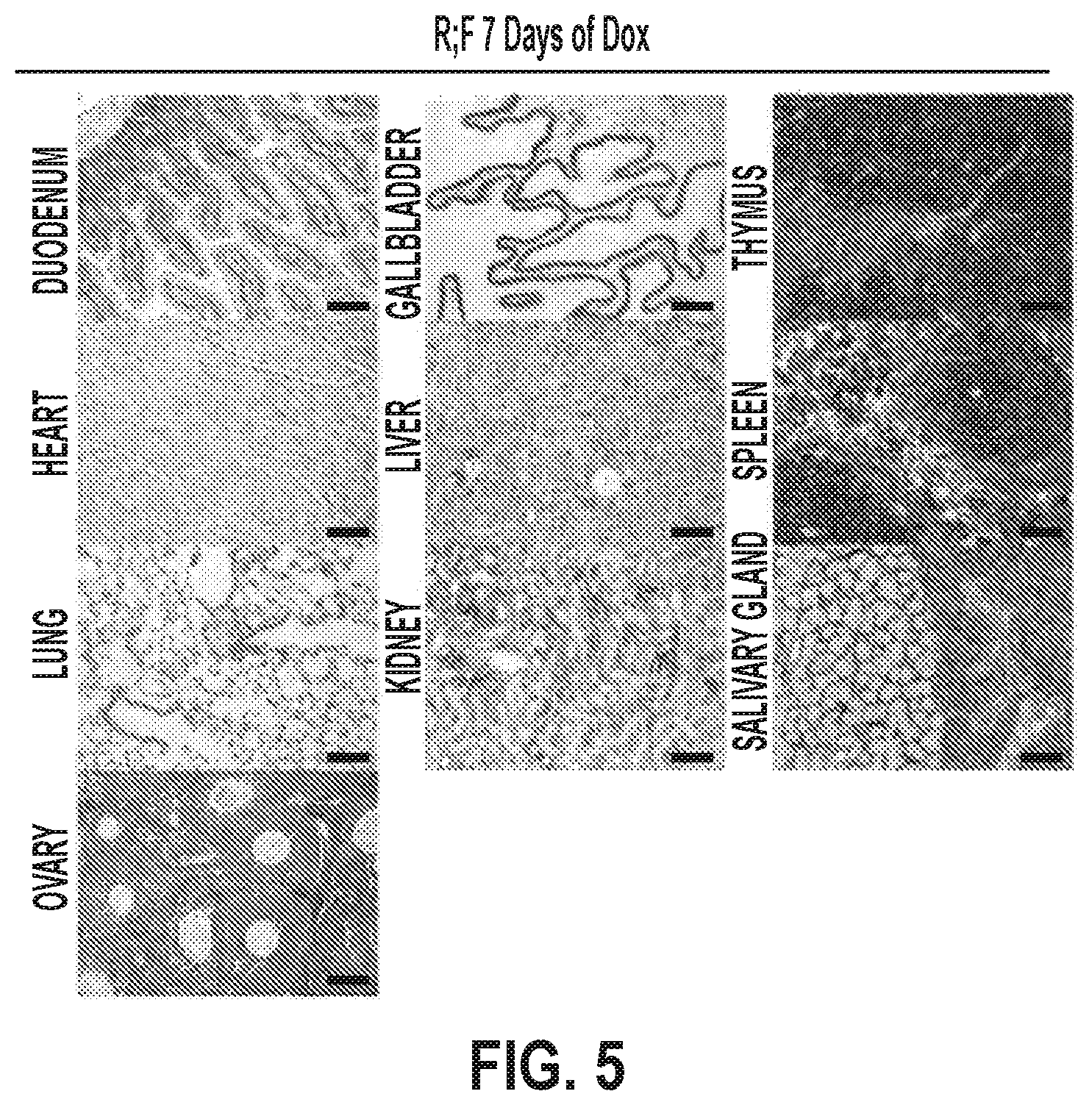 Patent US12378320 Figure 12 – Methods for treating pancreatitis