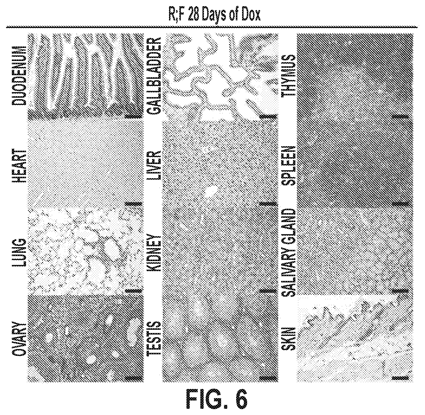 Patent US12378320 Figure 13 – Methods for treating pancreatitis