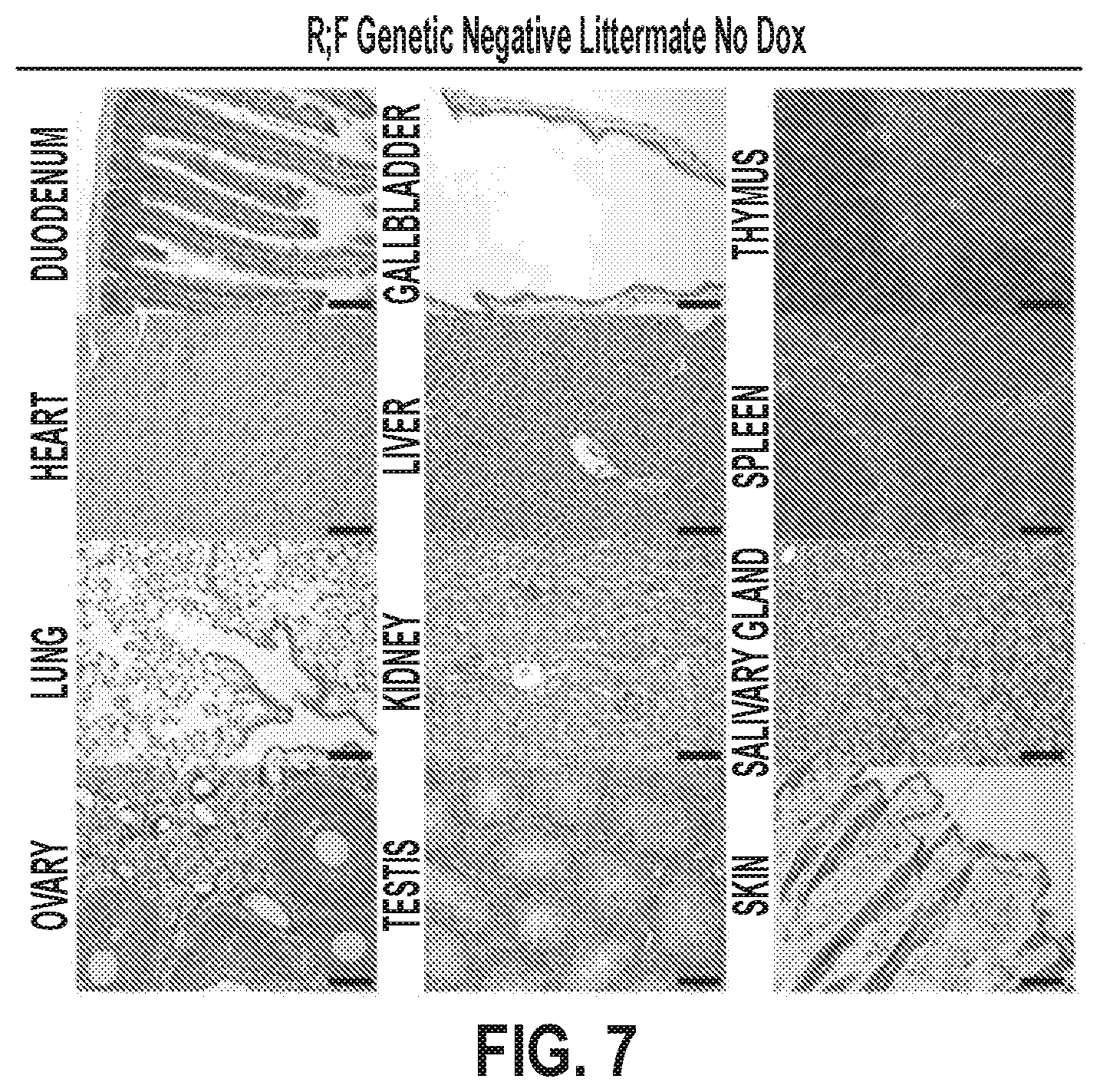 Patent US12378320 Figure 14 – Methods for treating pancreatitis