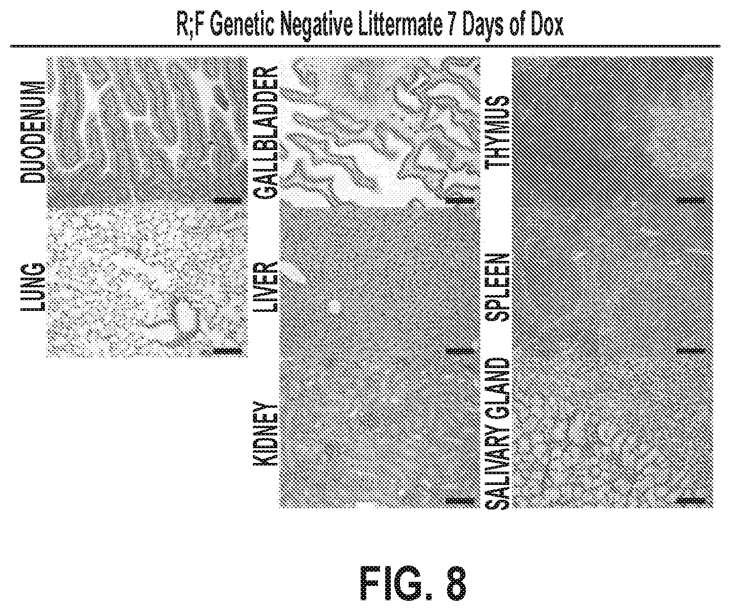 Patent US12378320 Figure 15 – Methods for treating pancreatitis