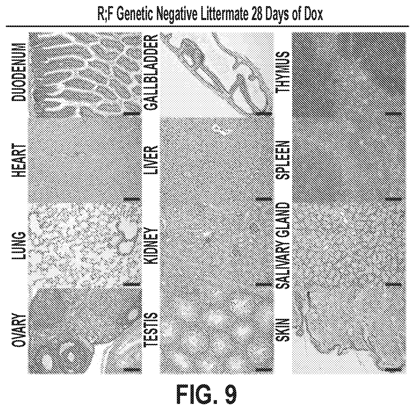 Patent US12378320 Figure 16 – Methods for treating pancreatitis