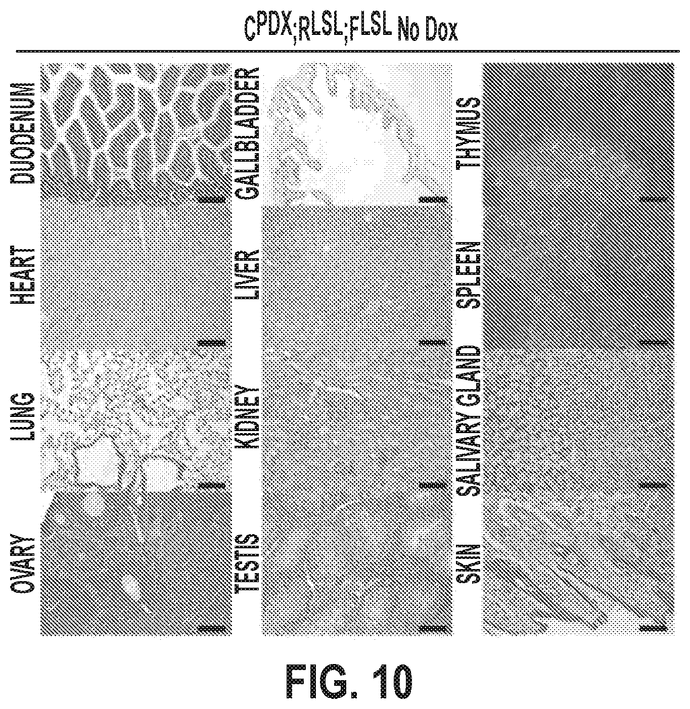 Patent US12378320 Figure 17 – Methods for treating pancreatitis