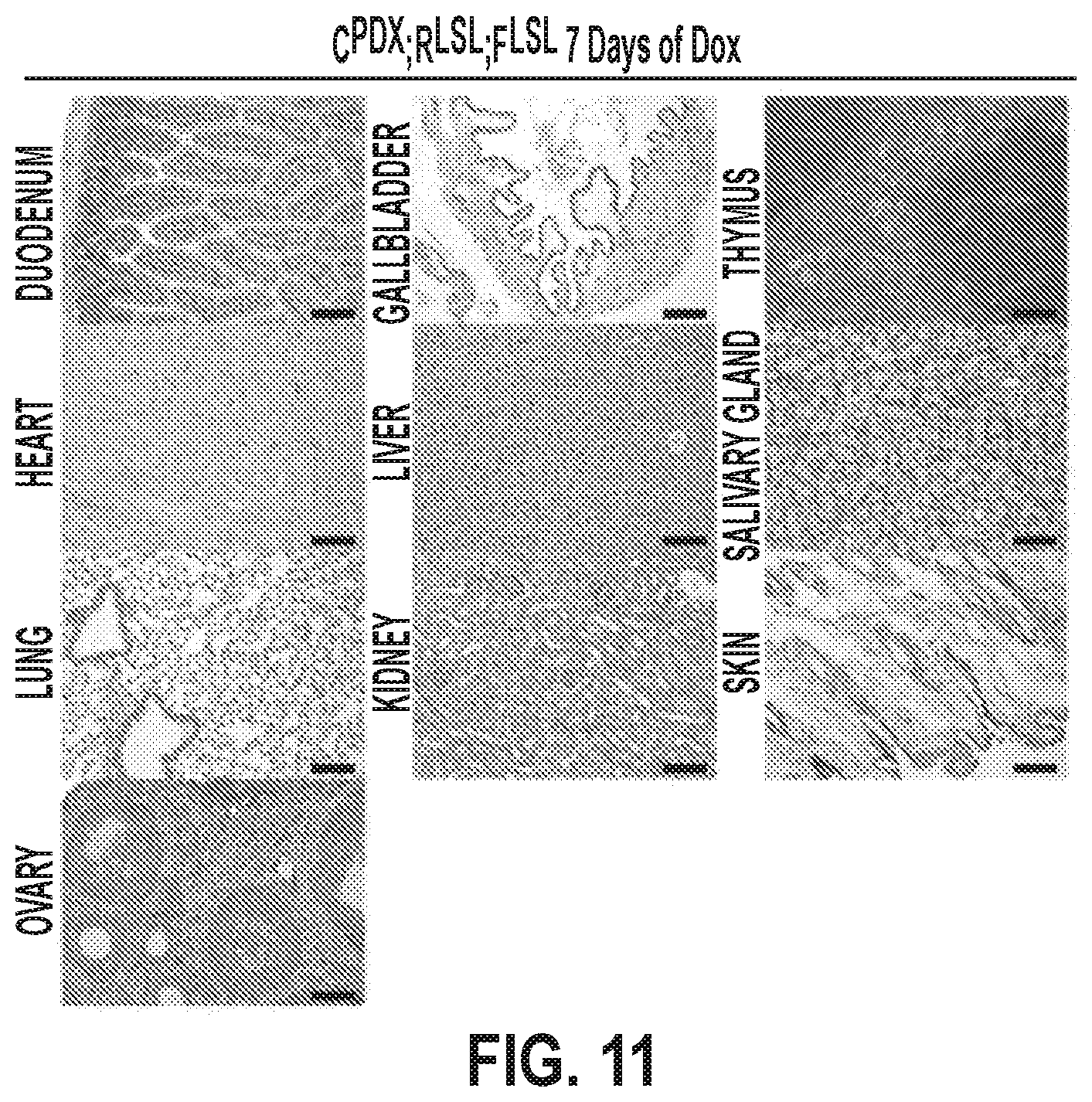 Patent US12378320 Figure 18 – Methods for treating pancreatitis