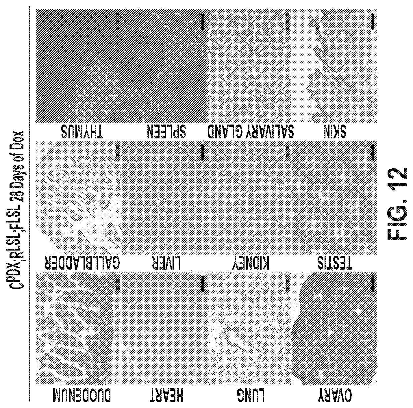 Patent US12378320 Figure 19 – Methods for treating pancreatitis
