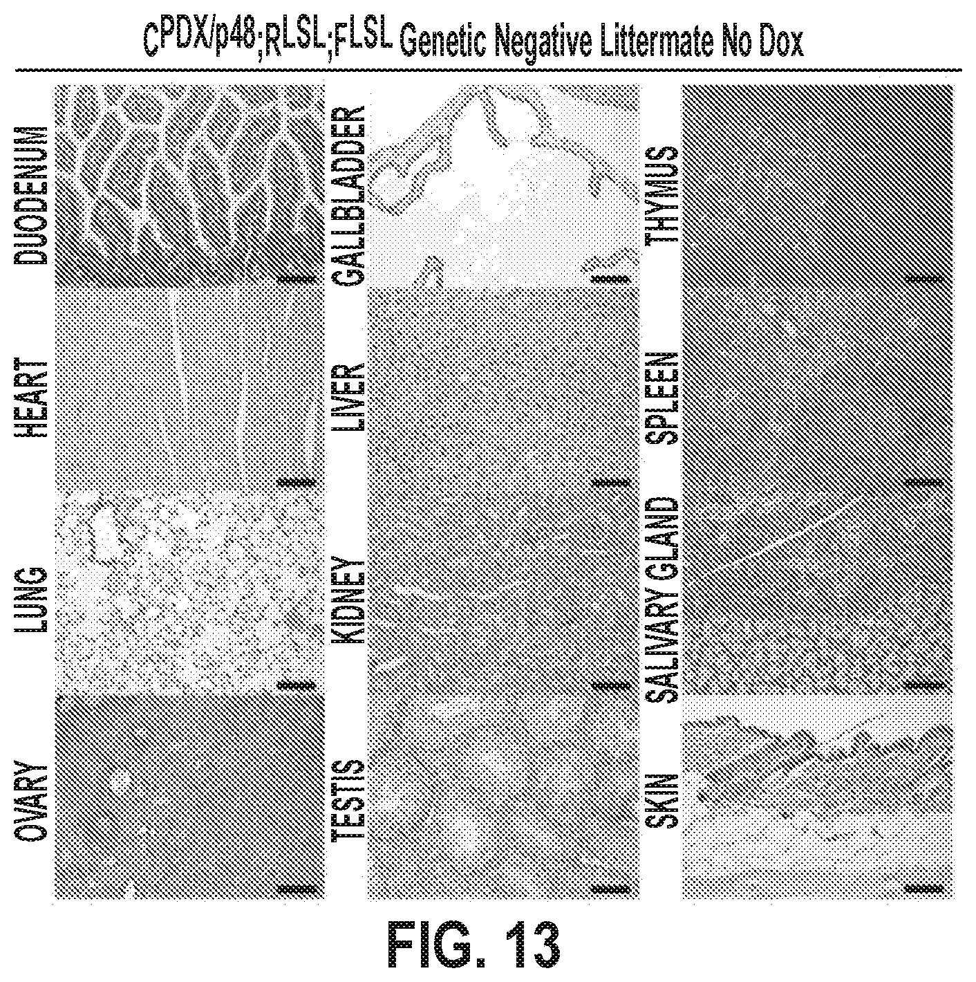 Patent US12378320 Figure 20 – Methods for treating pancreatitis