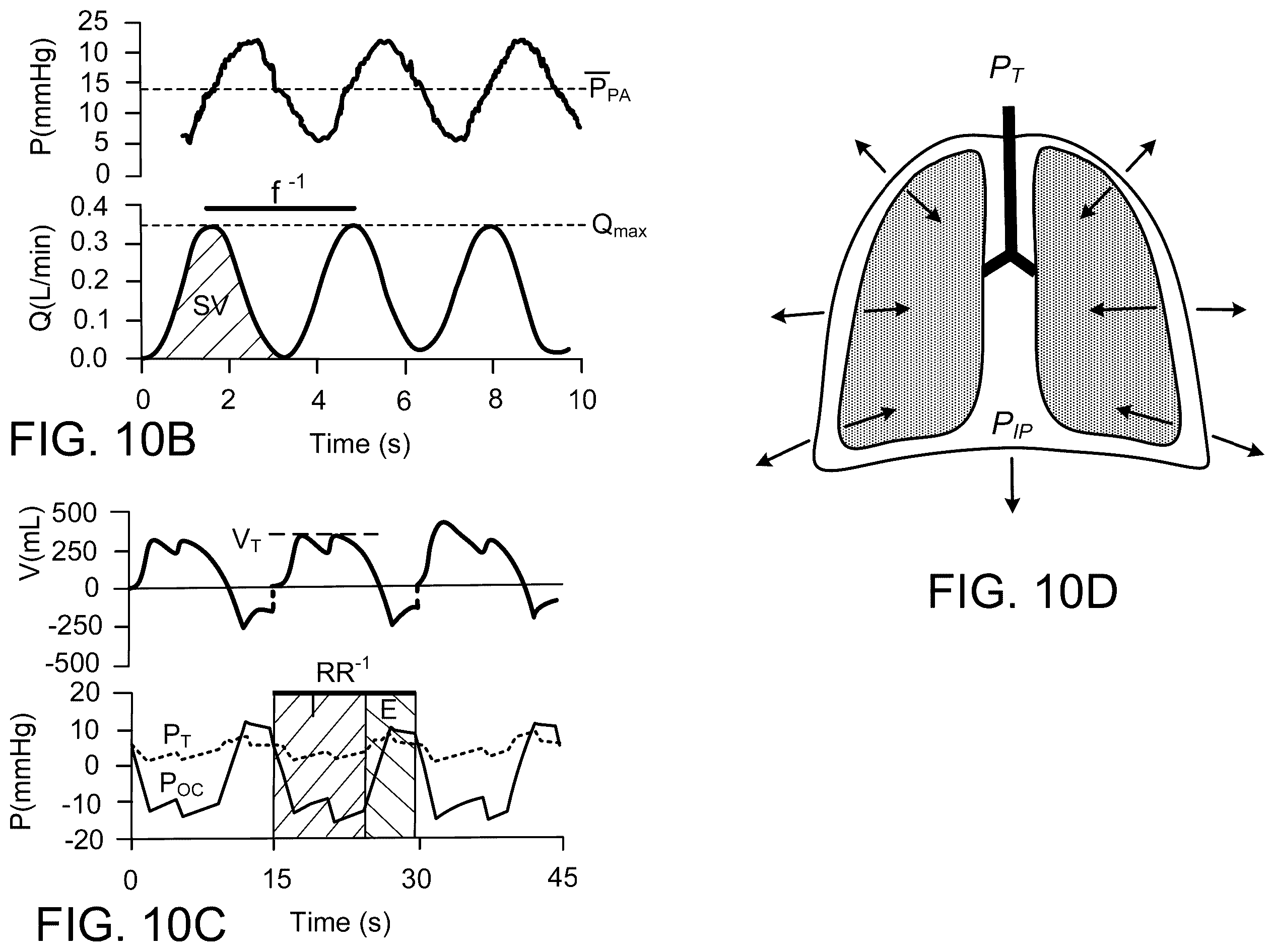 Patent US12378510 Figure 12 – Lung bioreactor