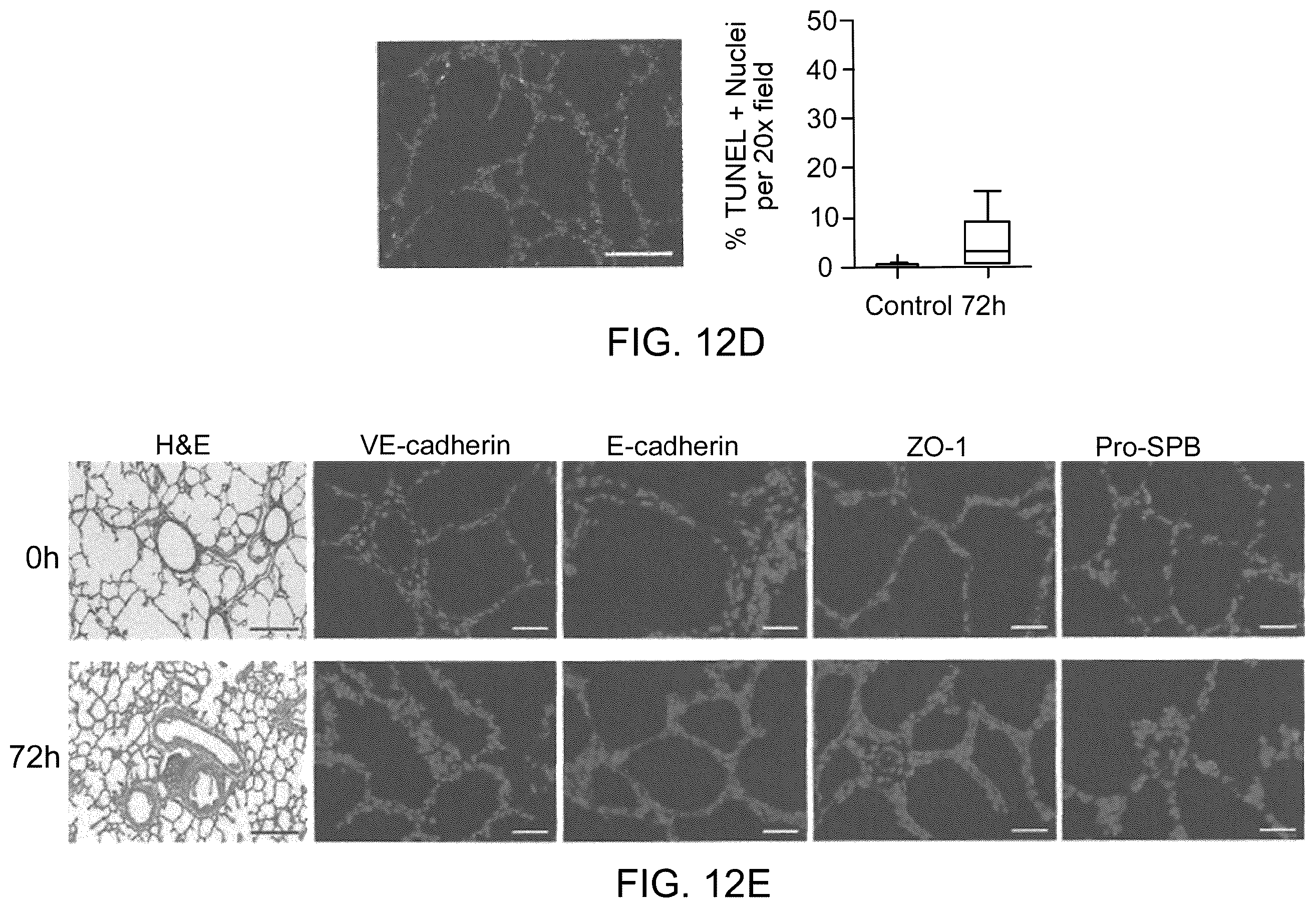 Patent US12378510 Figure 17 – Lung bioreactor