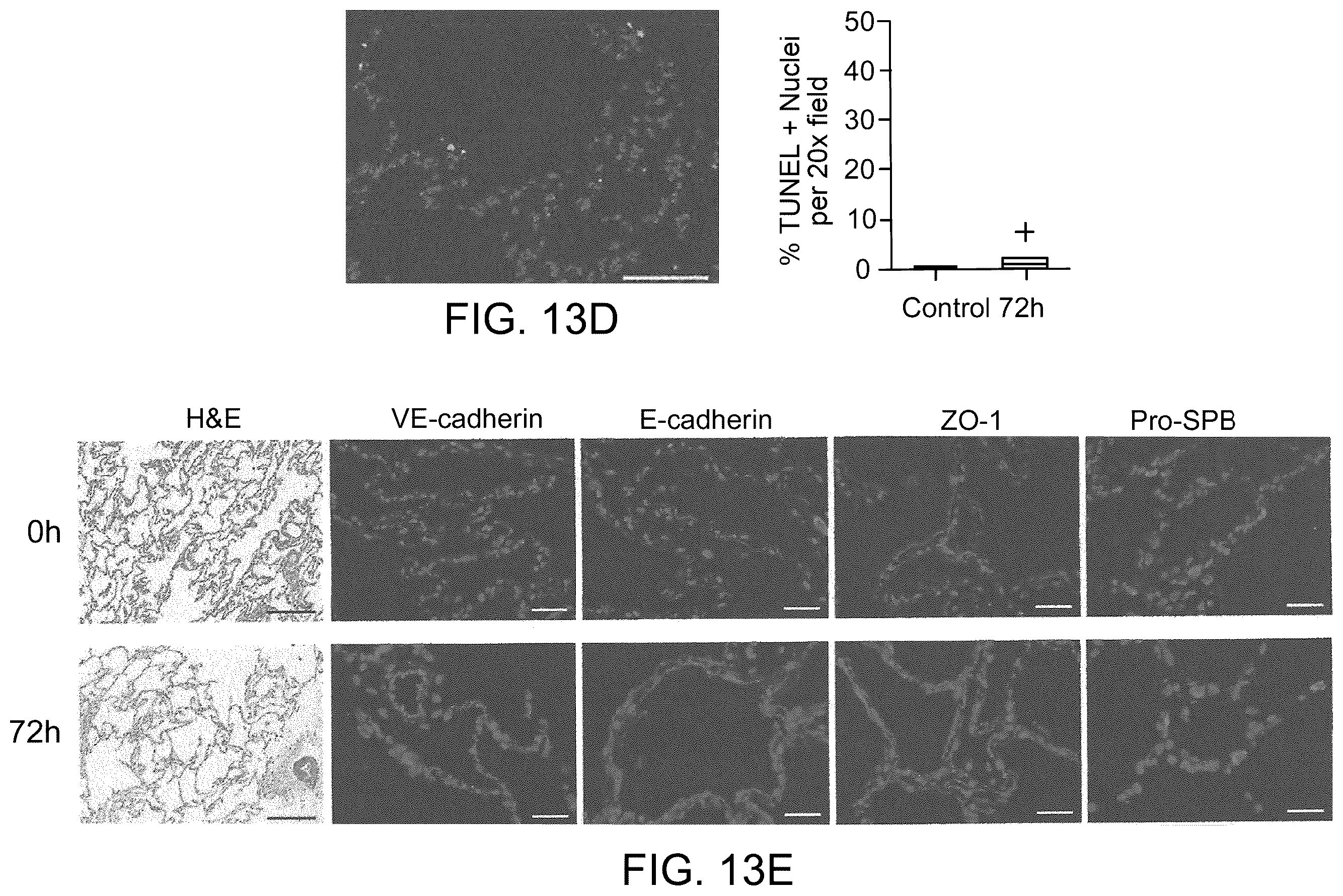 Patent US12378510 Figure 20 – Lung bioreactor