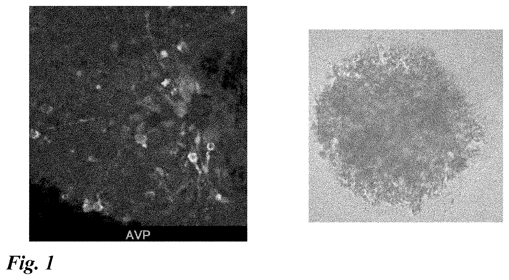 Patent US12378518 — Differentiation induction from human pluripotent stem cells into hypothalamic neurons — Figure 1