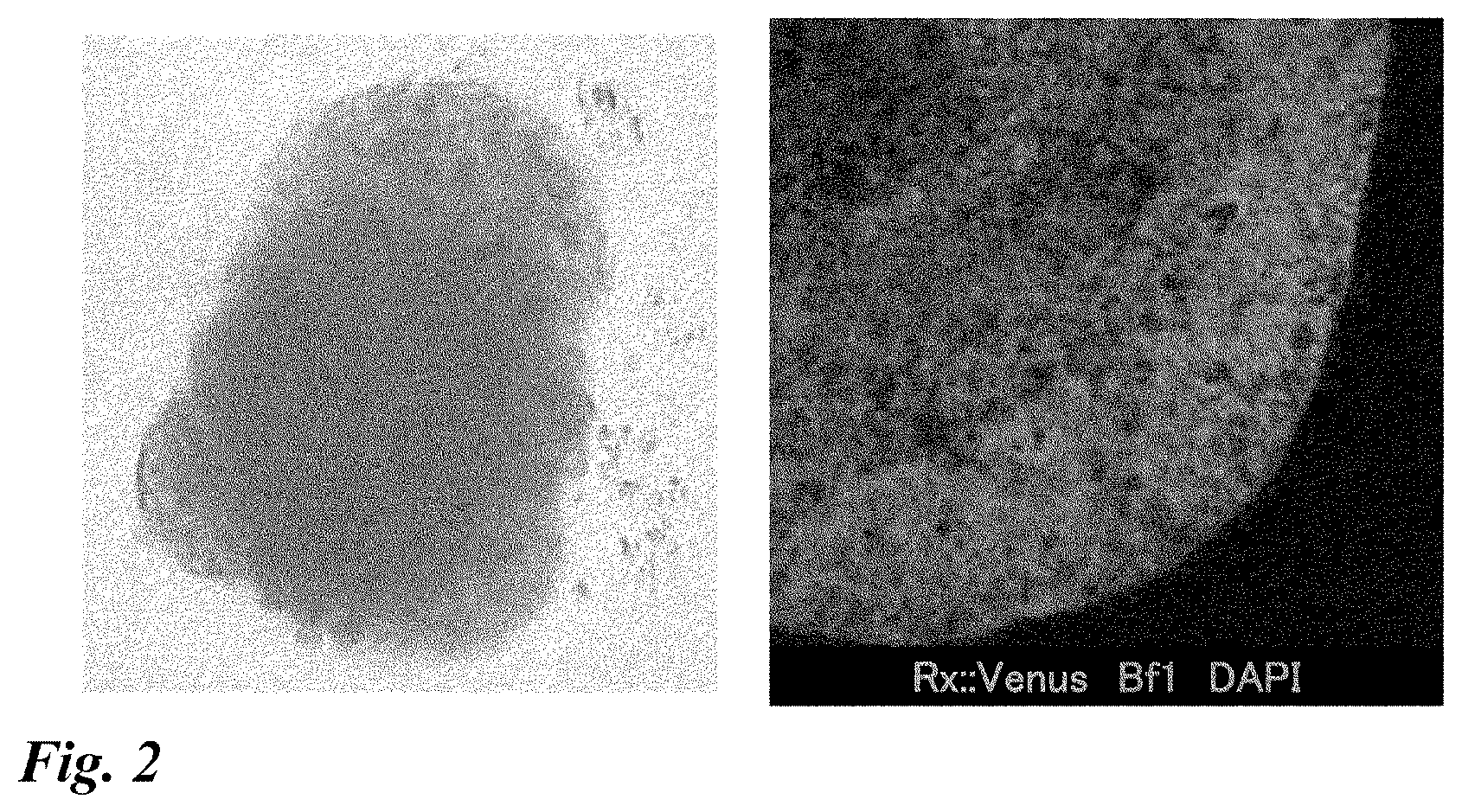 Patent US12378518 Figure 2 – Differentiation induction from human pluripotent stem cells into hypothalamic neurons