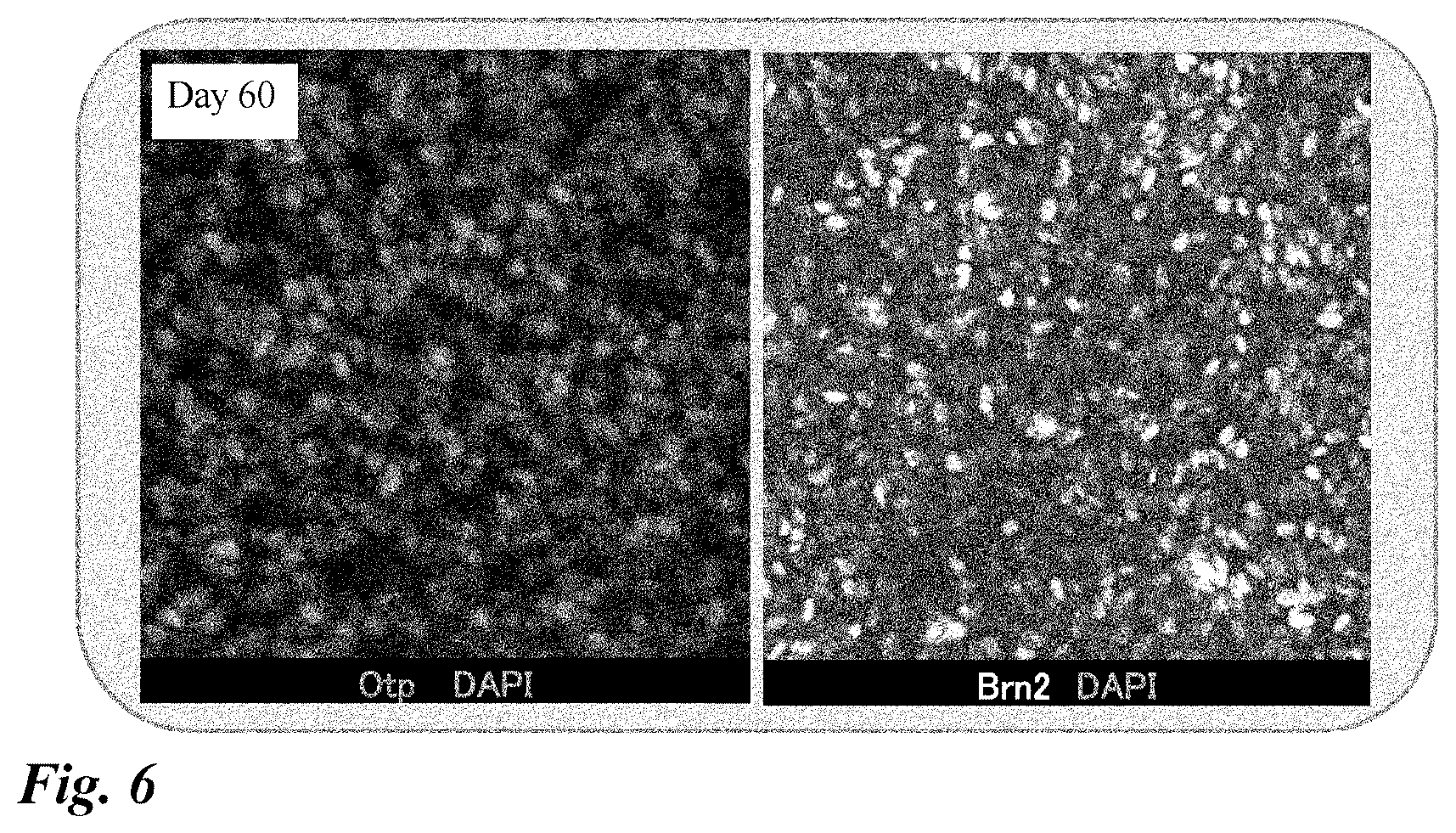 Patent US12378518 Figure 6 – Differentiation induction from human pluripotent stem cells into hypothalamic neurons