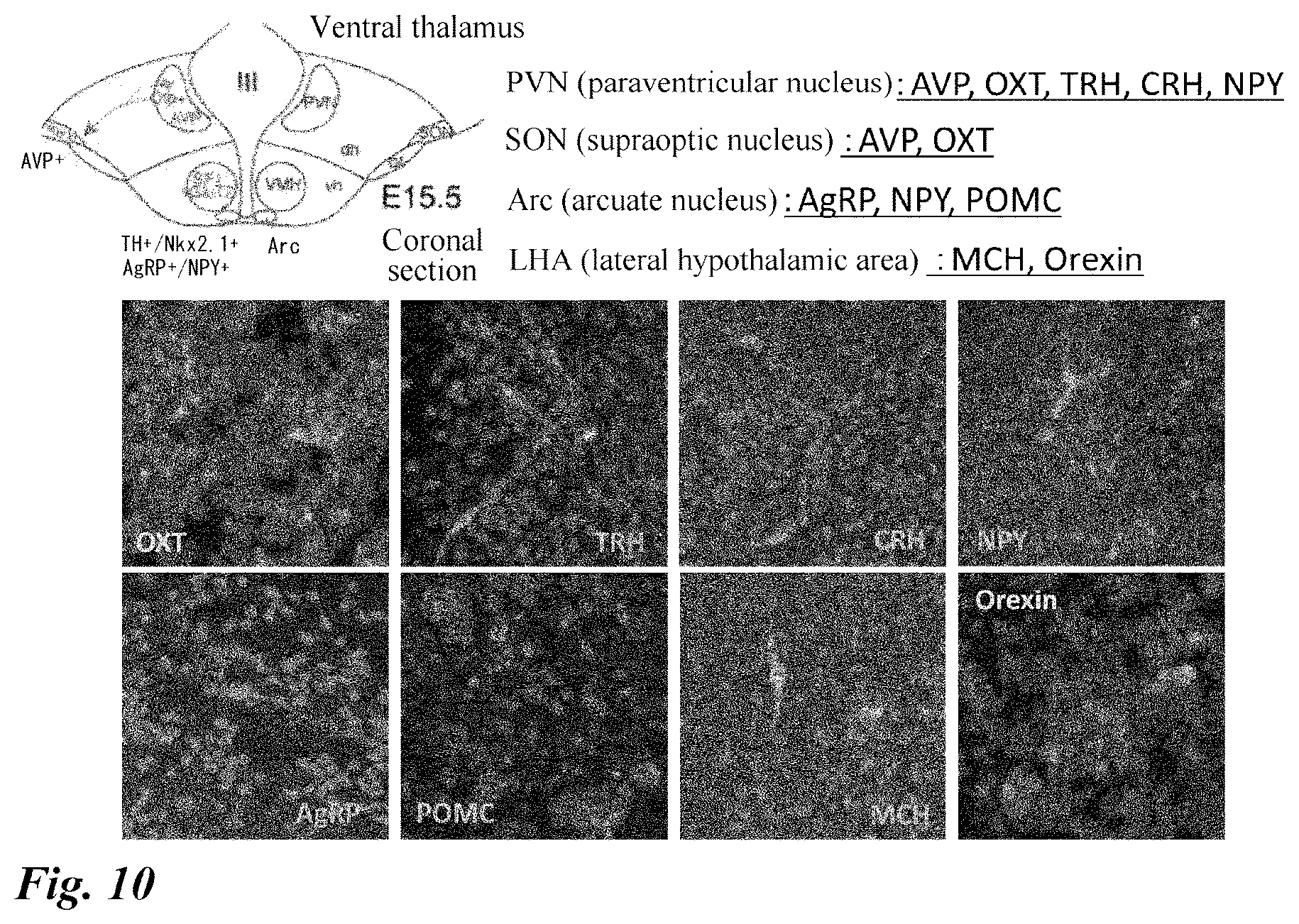 Patent US12378518 Figure 10 – Differentiation induction from human pluripotent stem cells into hypothalamic neurons